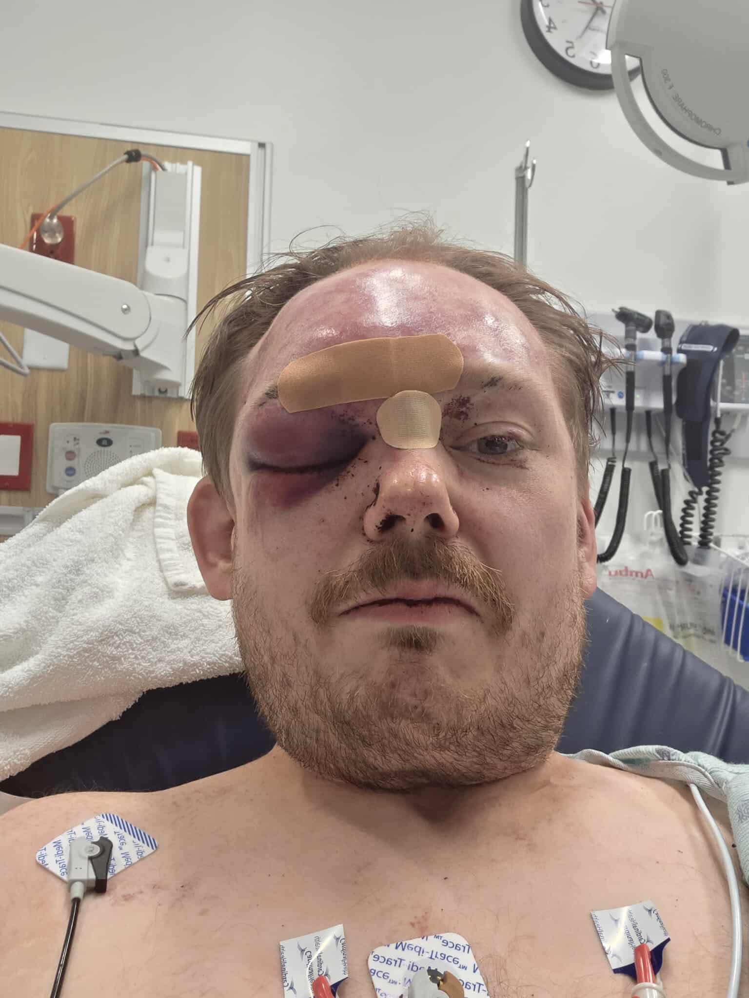 Help Jason Cooper Recover from Brutal Assault campaign photo, 2 of 7