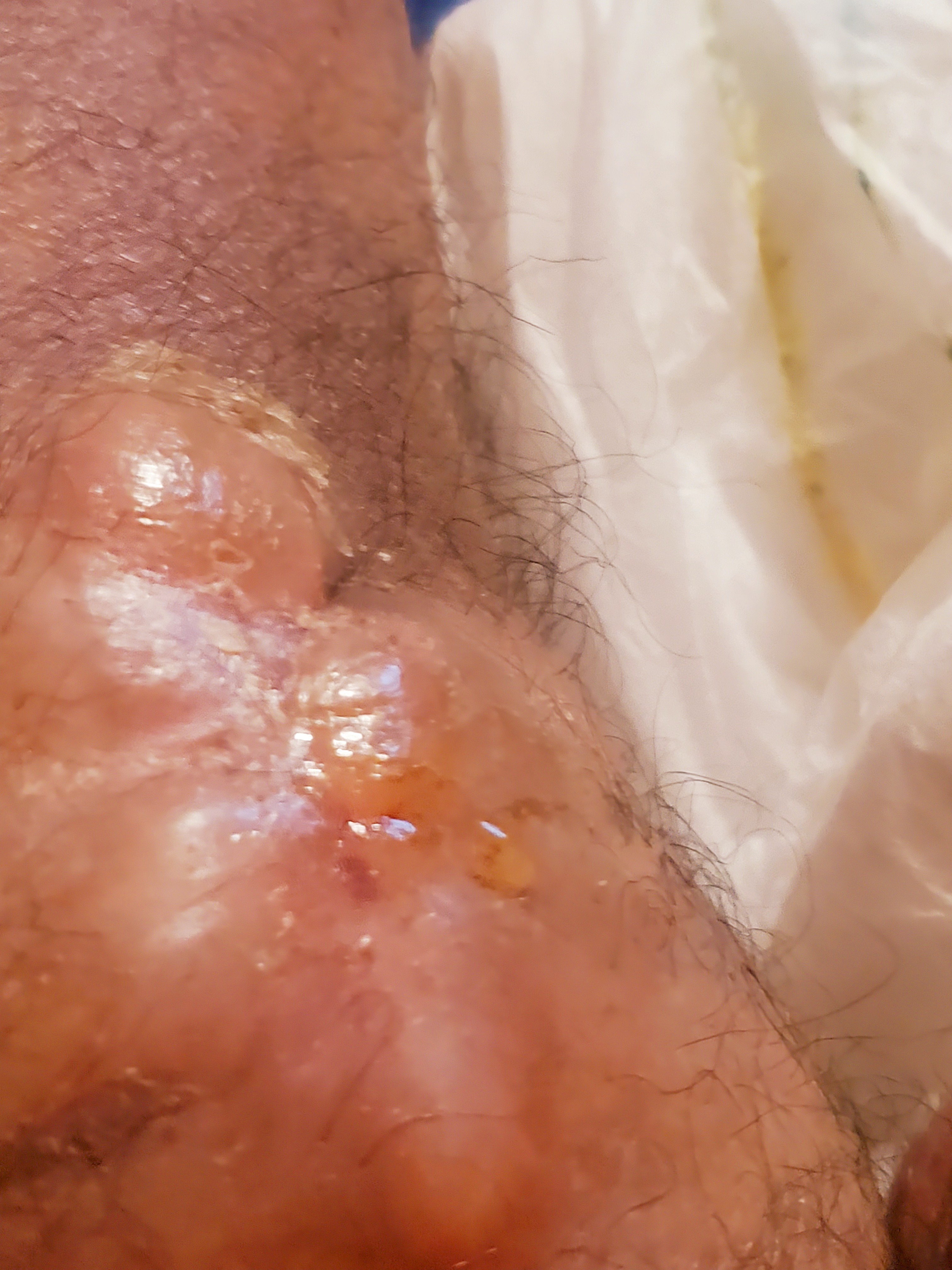 Please donate to help assist in medical bills. campaign photo, 2 of 5
