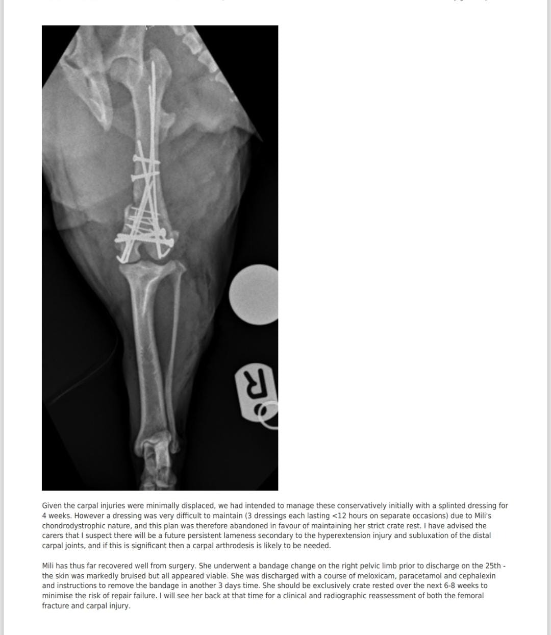 Mili's surgery campaign photo, 4 of 6