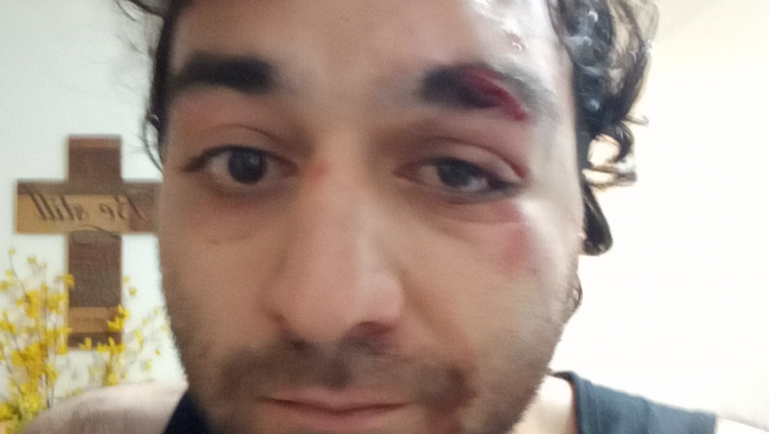 David Aliabadi with this rare epileptic disorder :( photo