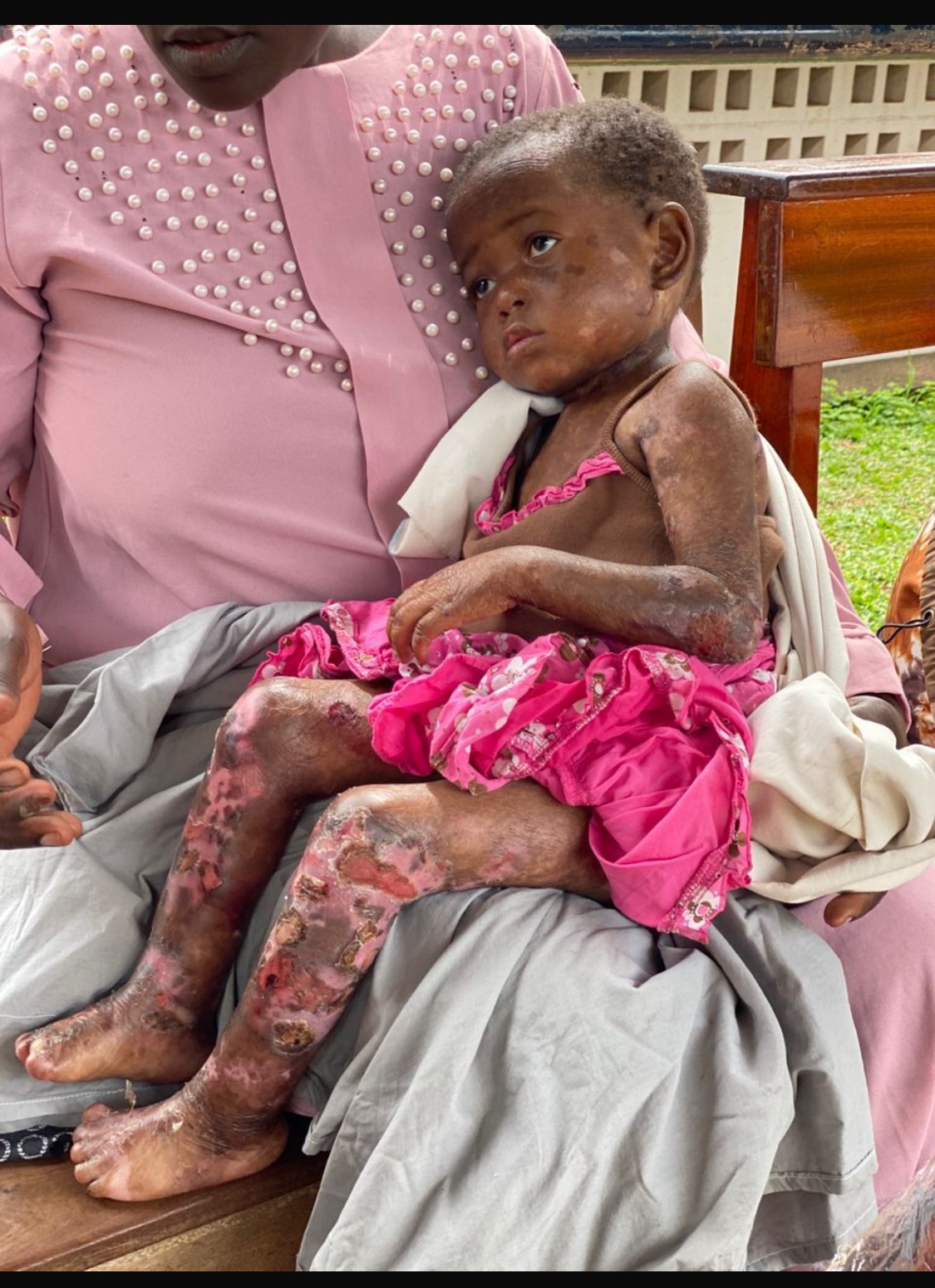 A Life of Pain-Let’s Give Lauza a Chance at Some Comfort campaign photo, 7 of 8