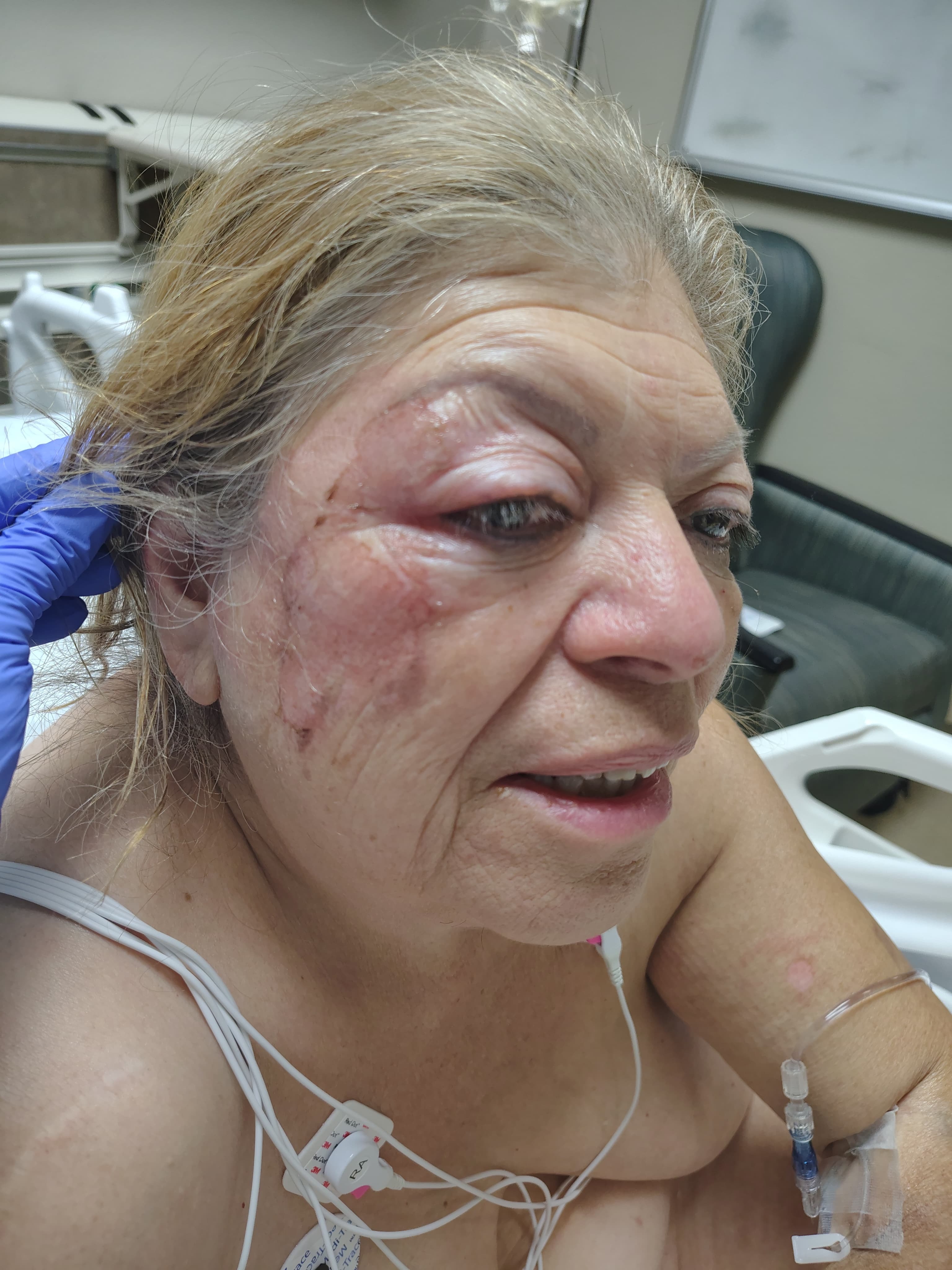 aunts medical & finacial struggle campaign photo, 2 of 8
