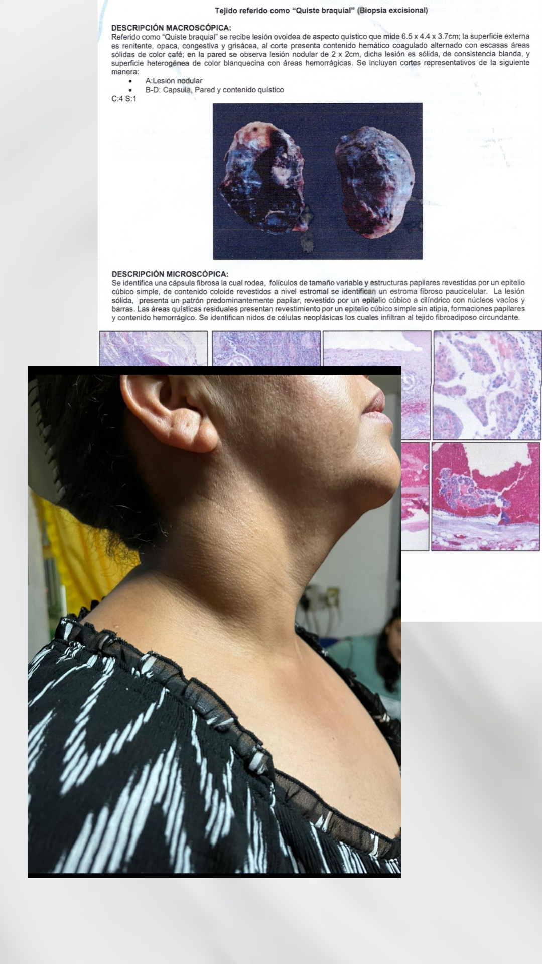 Eugenia Guerrero necesita tu ayuda para vencer al cáncer campaign photo, 2 of 7