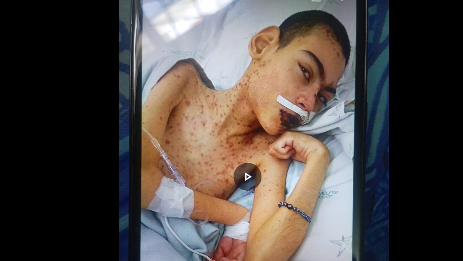 Apoya a mi sobrino Matías: 13años de lucha y amor campaign photo, 6 of 8