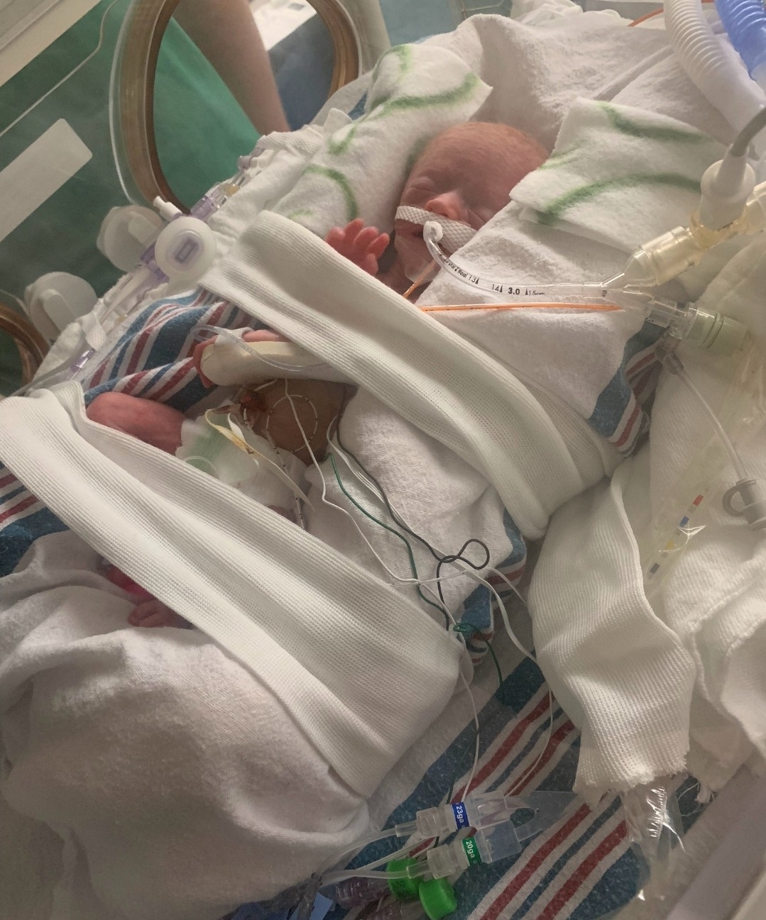 Keep Baby Wren's Family Together Through Her NICU Journey campaign photo, 2 of 6