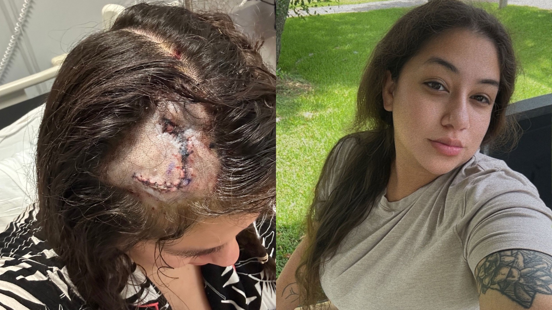 Help Kat Through brain Surgery Complications campaign photo, 4 of 5