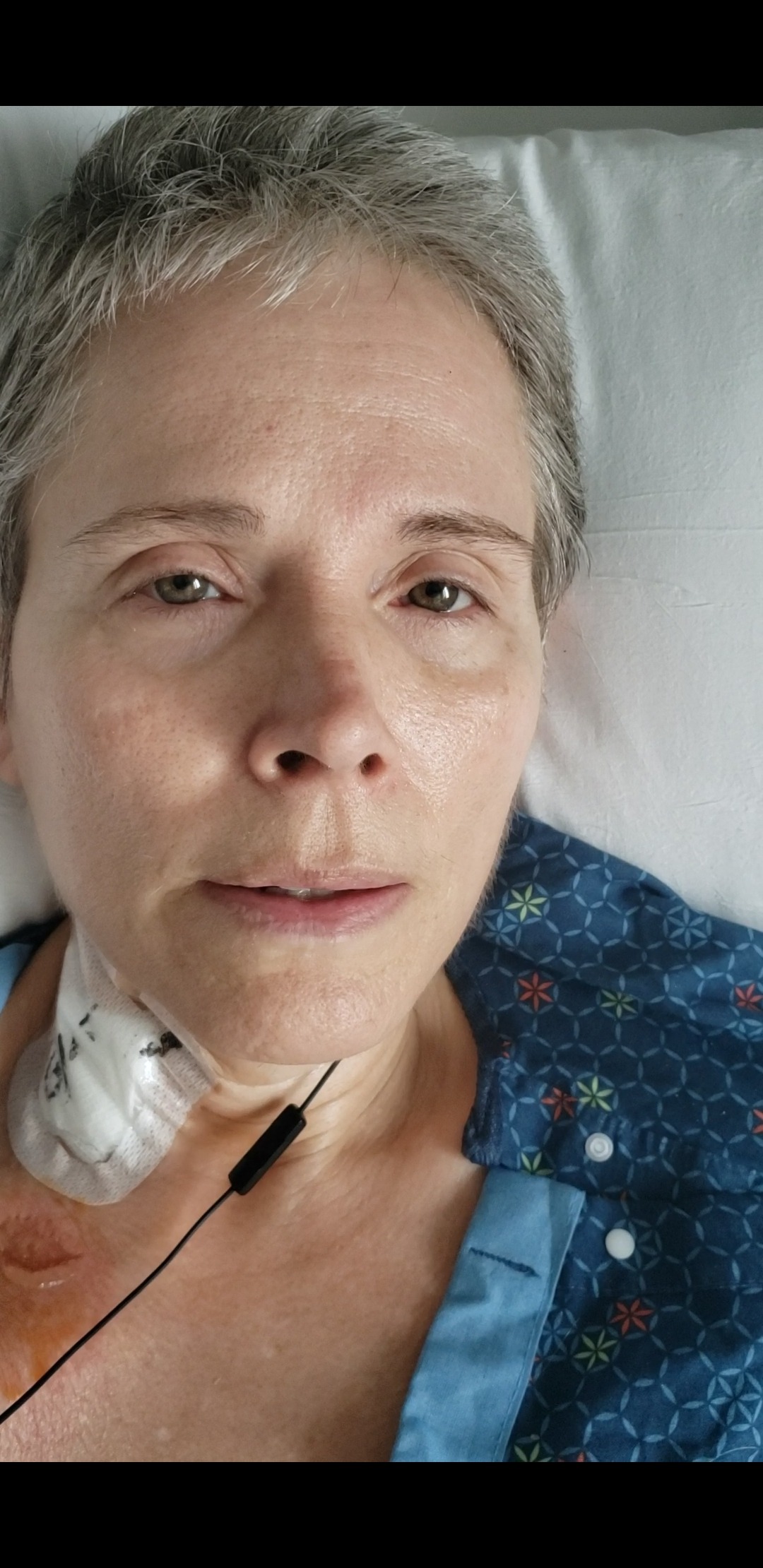 Urgent Skin Cancer Treatment Needed campaign photo, 4 of 7