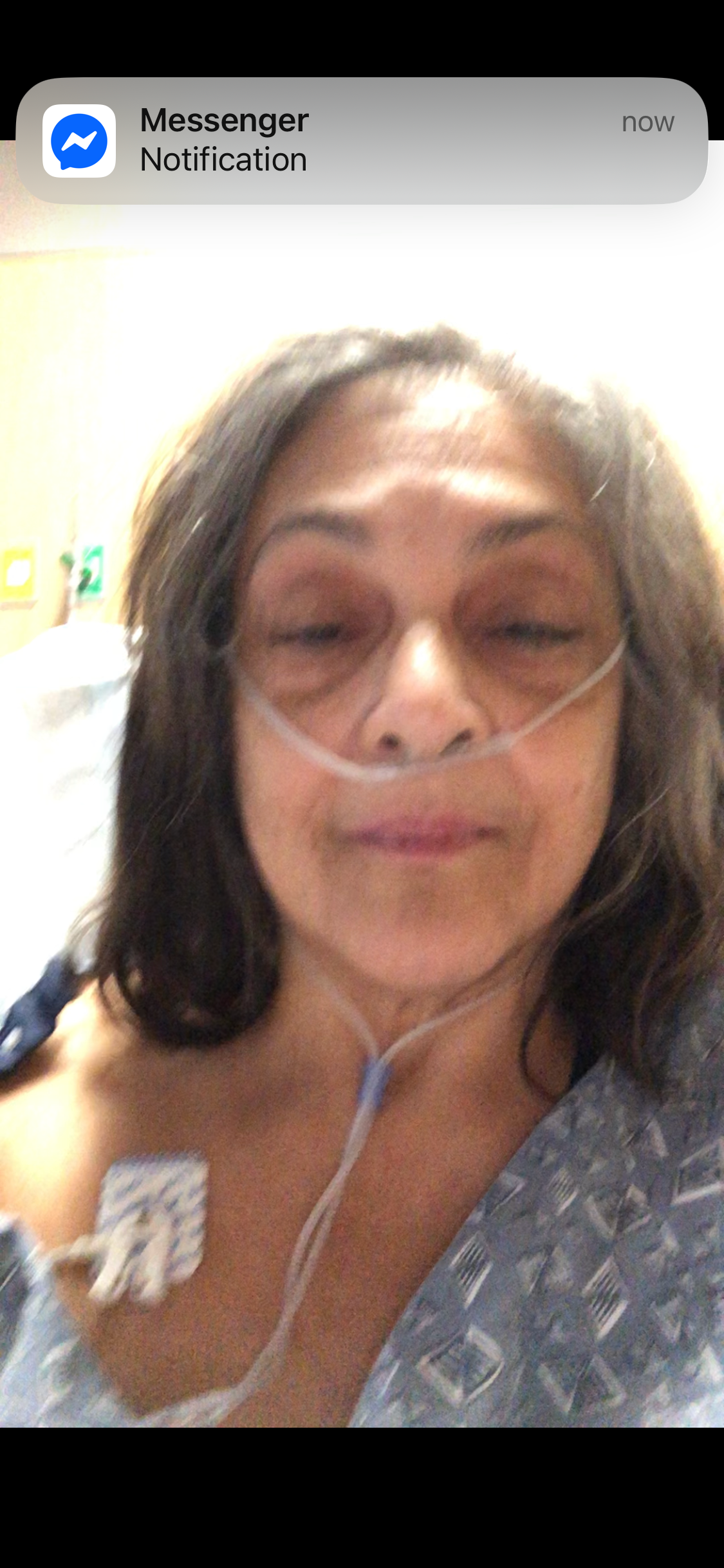 Post-Surgery Hardships campaign photo, 4 of 5