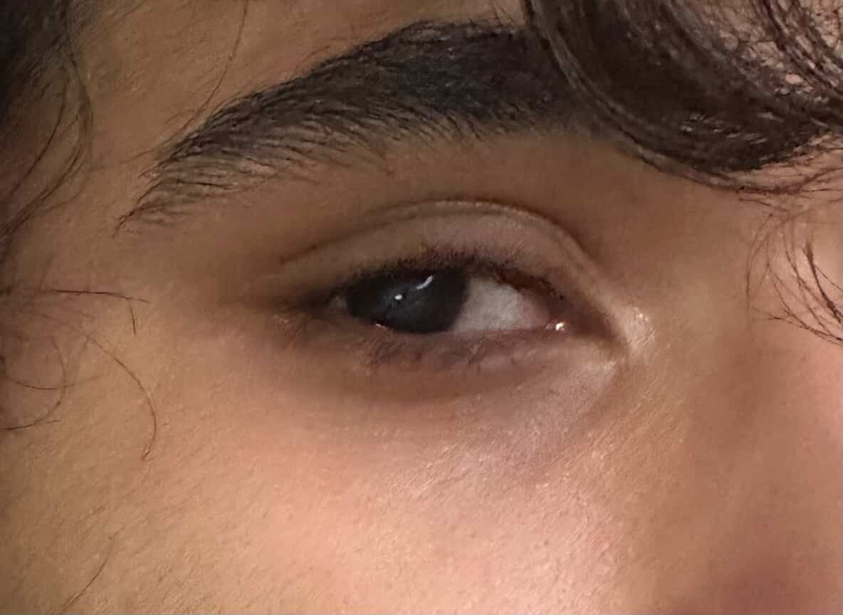 Family Plea: Restore Kevin's Eyesight campaign photo, 4 of 5