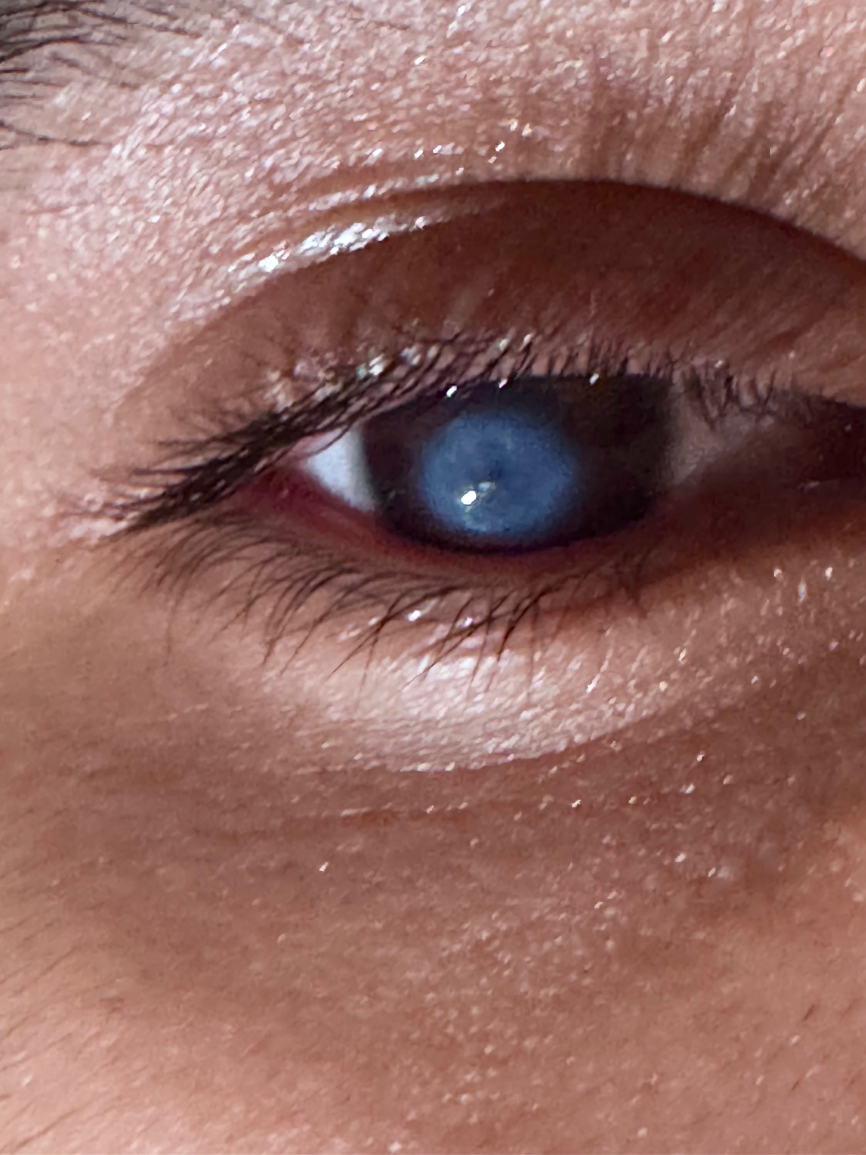 Family Plea: Restore Kevin's Eyesight campaign photo, 2 of 5