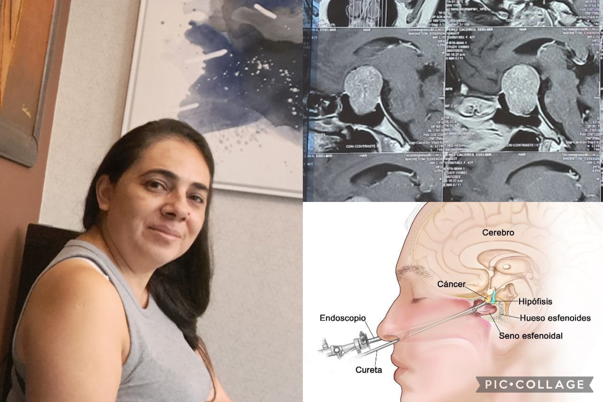 Help Rosario, she’s in need of a surgery to a brain tumors campaign photo, 6 of 7