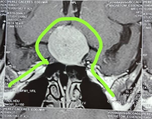 Help Rosario, she’s in need of a surgery to a brain tumors campaign photo, 2 of 7