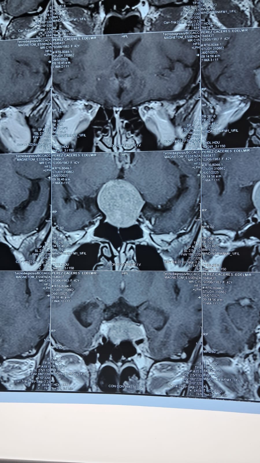 Help Rosario, she’s in need of a surgery to a brain tumors campaign photo, 4 of 7