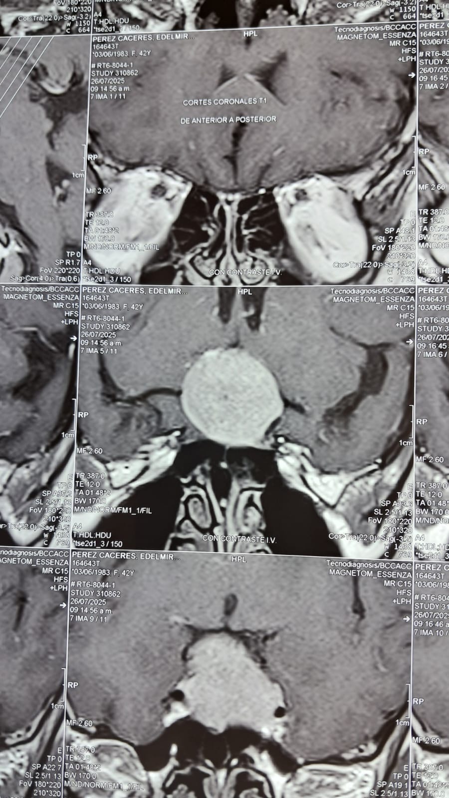 Help Rosario, she’s in need of a surgery to a brain tumors campaign photo, 5 of 7