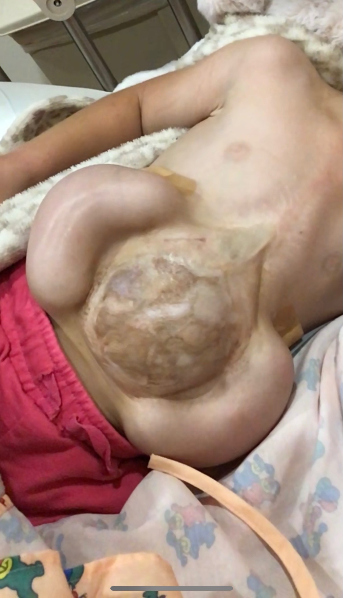 Join Averly's Fight: Surgery on August 5th campaign photo, 4 of 7