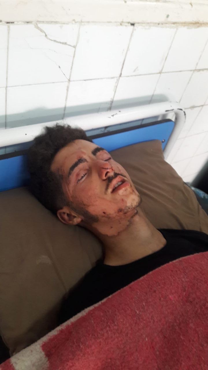 Help My Family Evacuate Gaza & Save My Injured Brother campaign photo, 2 of 7