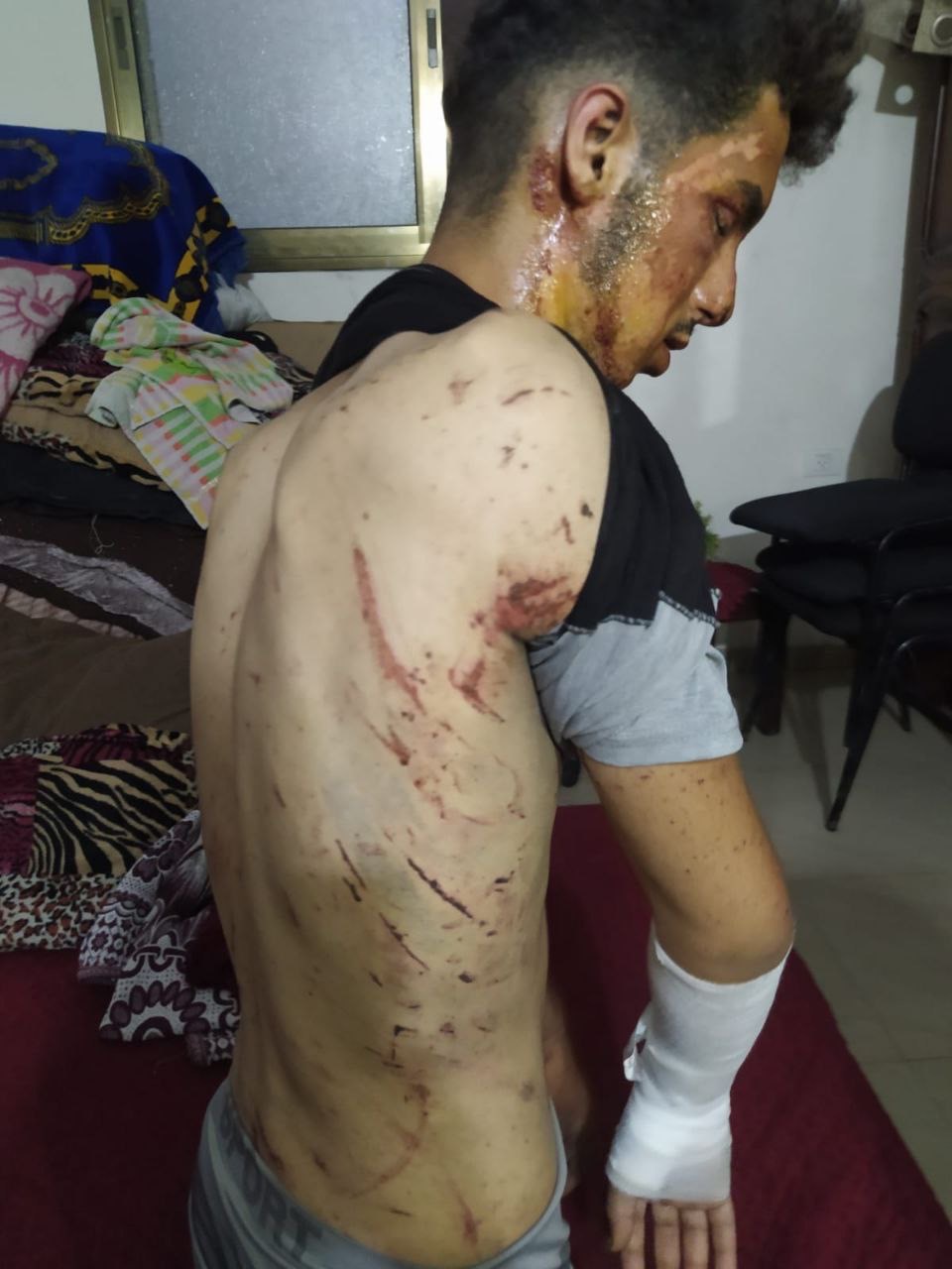 Help My Family Evacuate Gaza & Save My Injured Brother campaign photo, 5 of 7