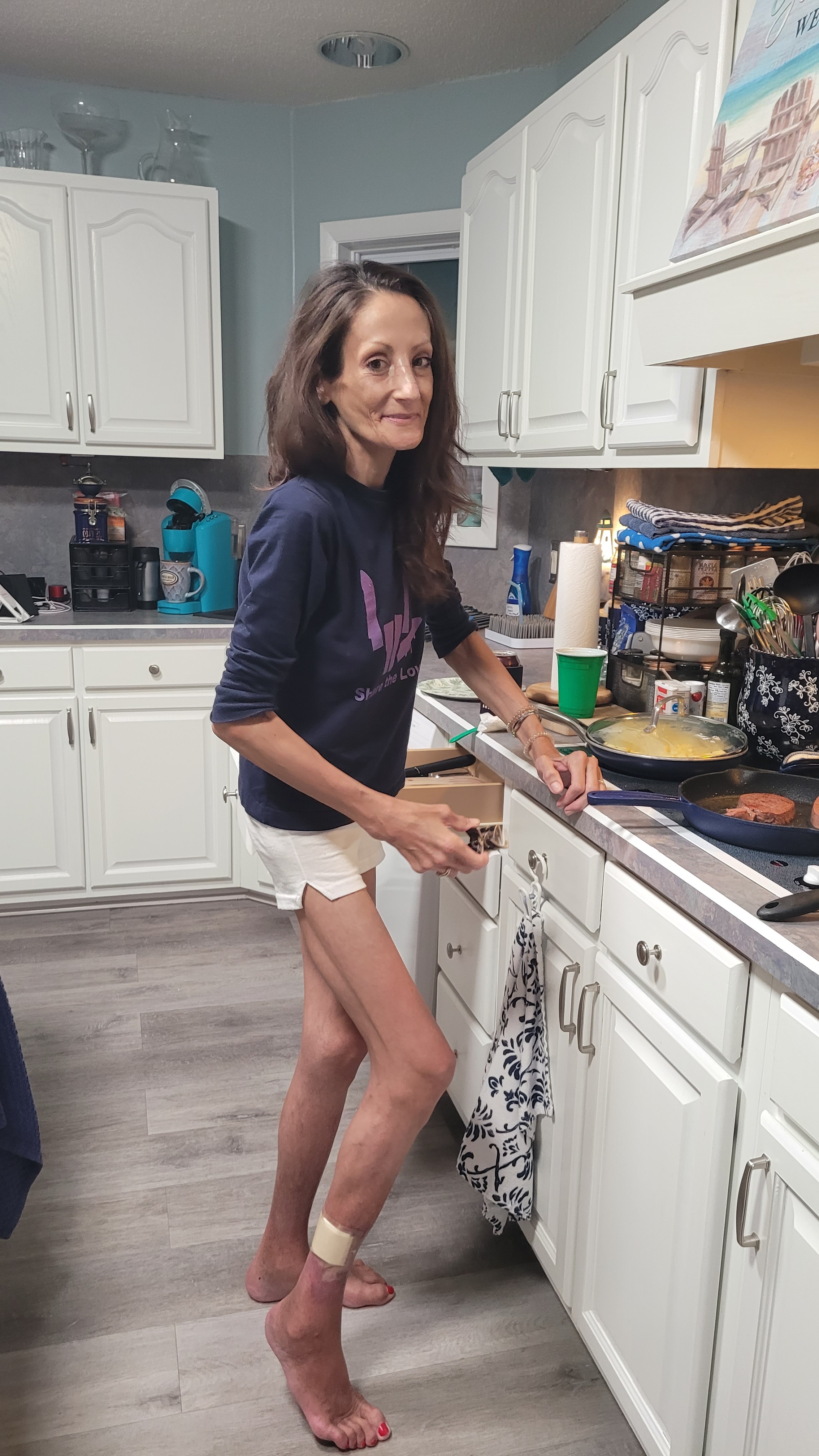 Lindsey's Journey to Health and Hope campaign photo, 6 of 7