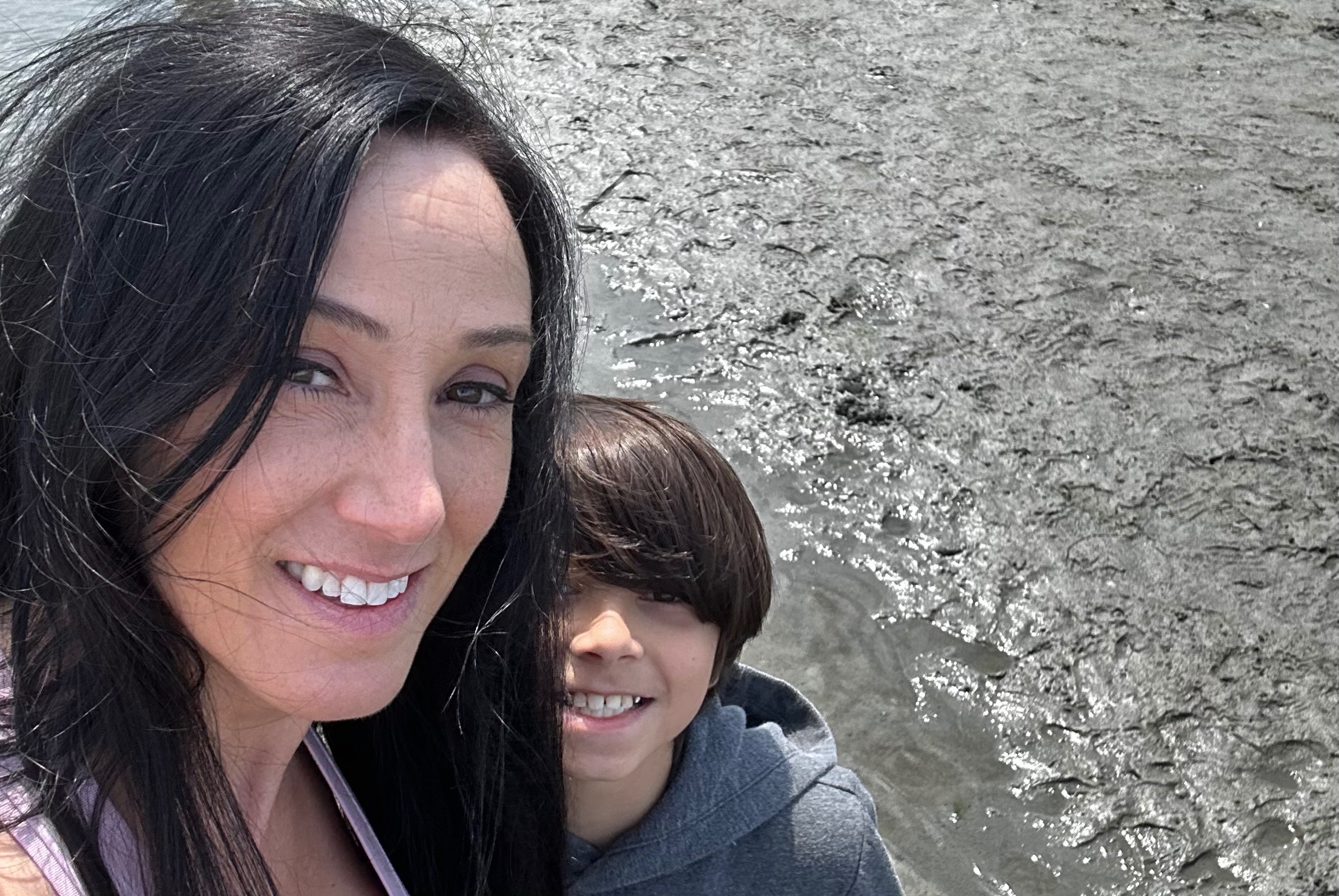 Help Anne Get Life-Saving Surgery campaign photo, 2 of 4