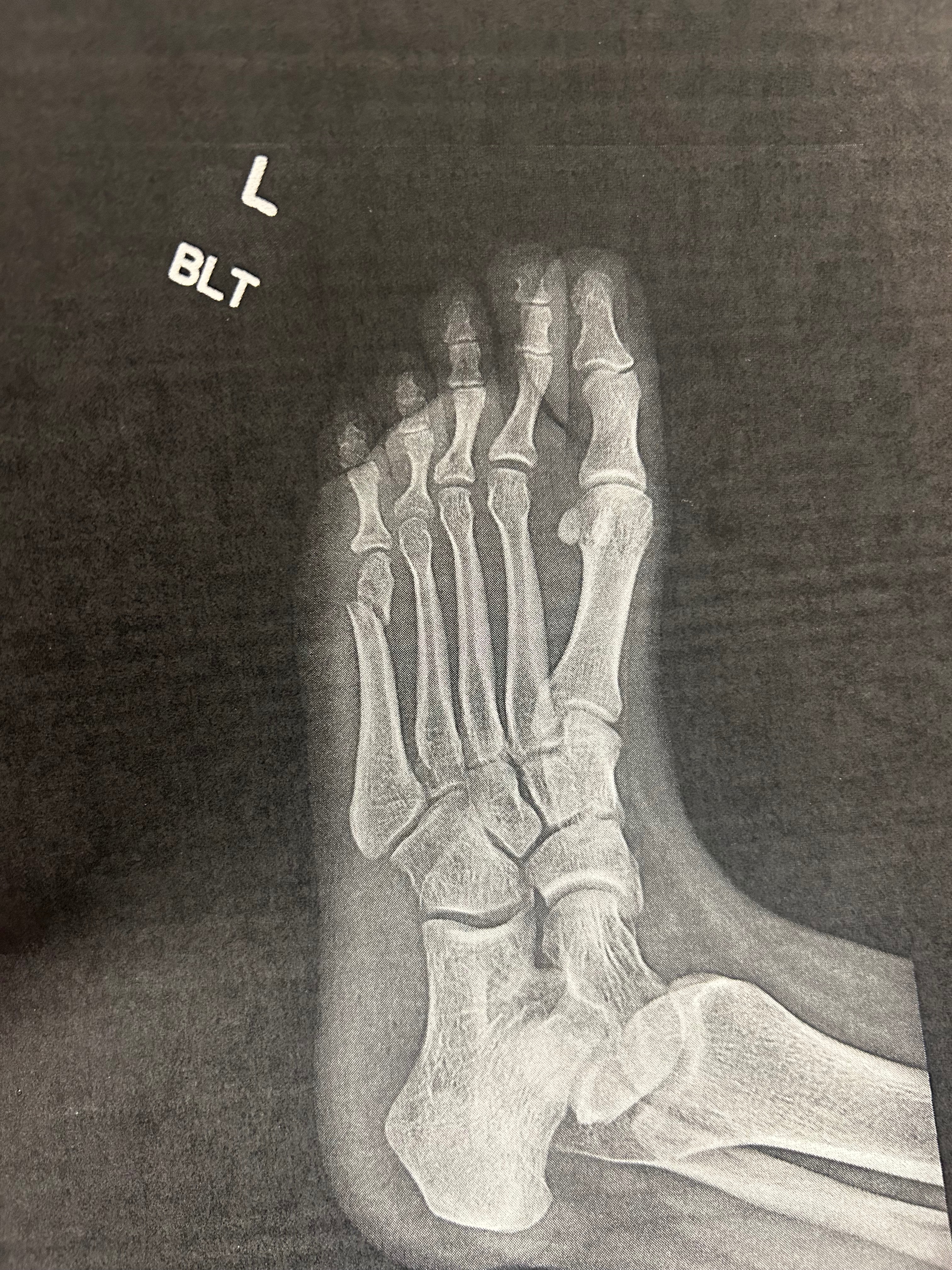 Savana Needs Your Help: Broken Foot Relief campaign photo, 2 of 4