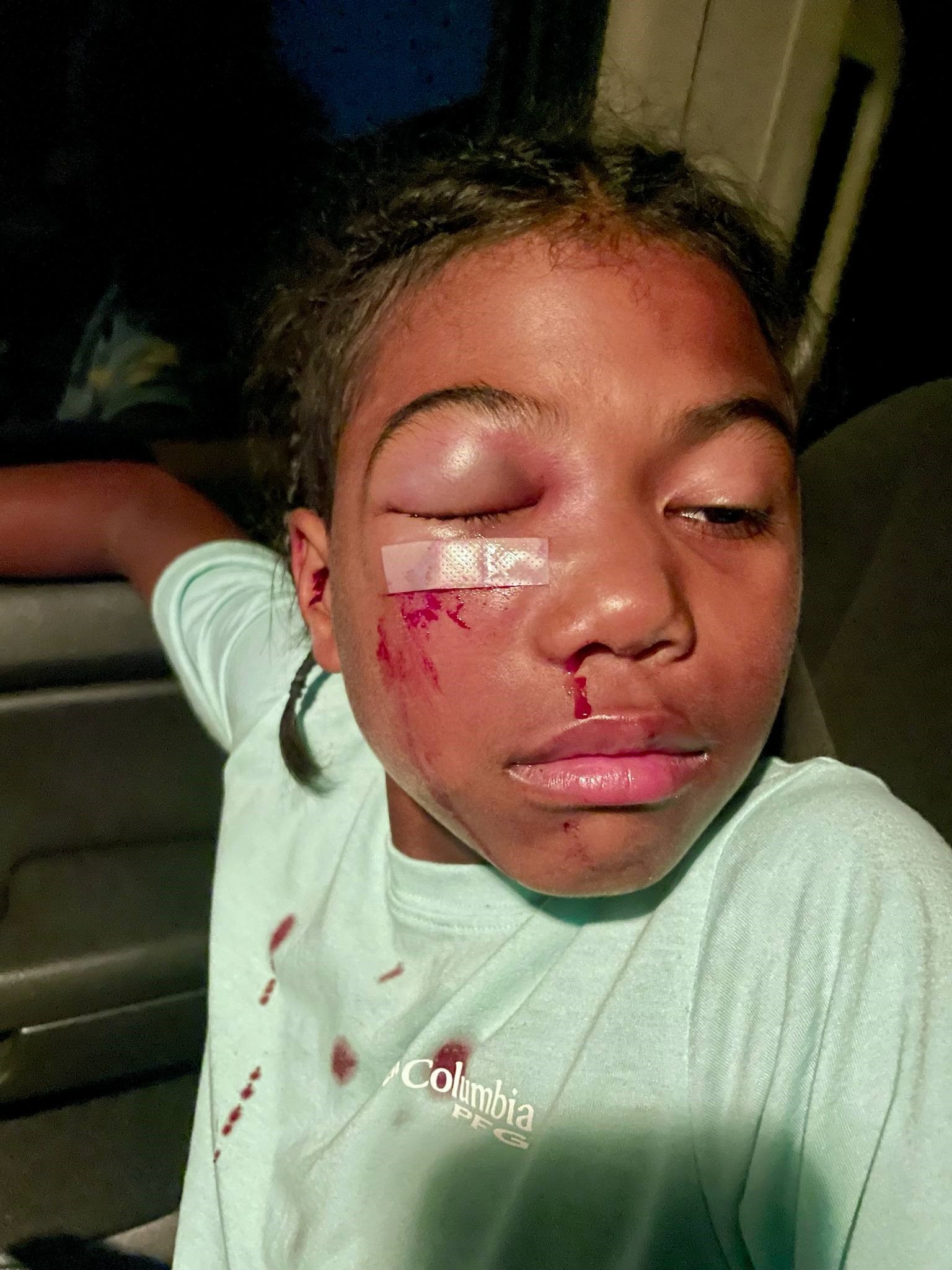 Help Kaleb Heal: Baseball Accident Recovery campaign photo, 6 of 7