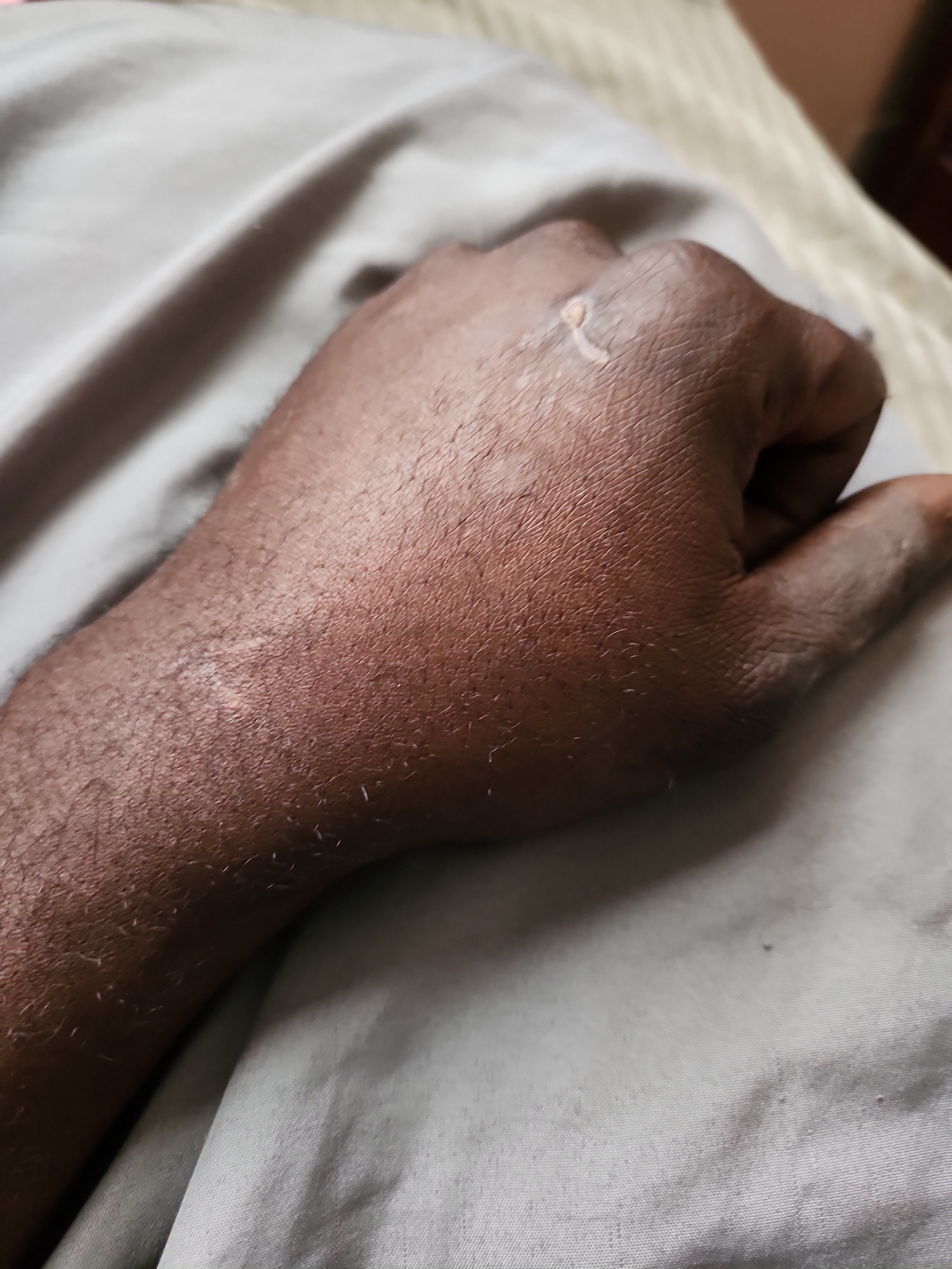 Help Ernecko Heal After Car Accident campaign photo, 4 of 7