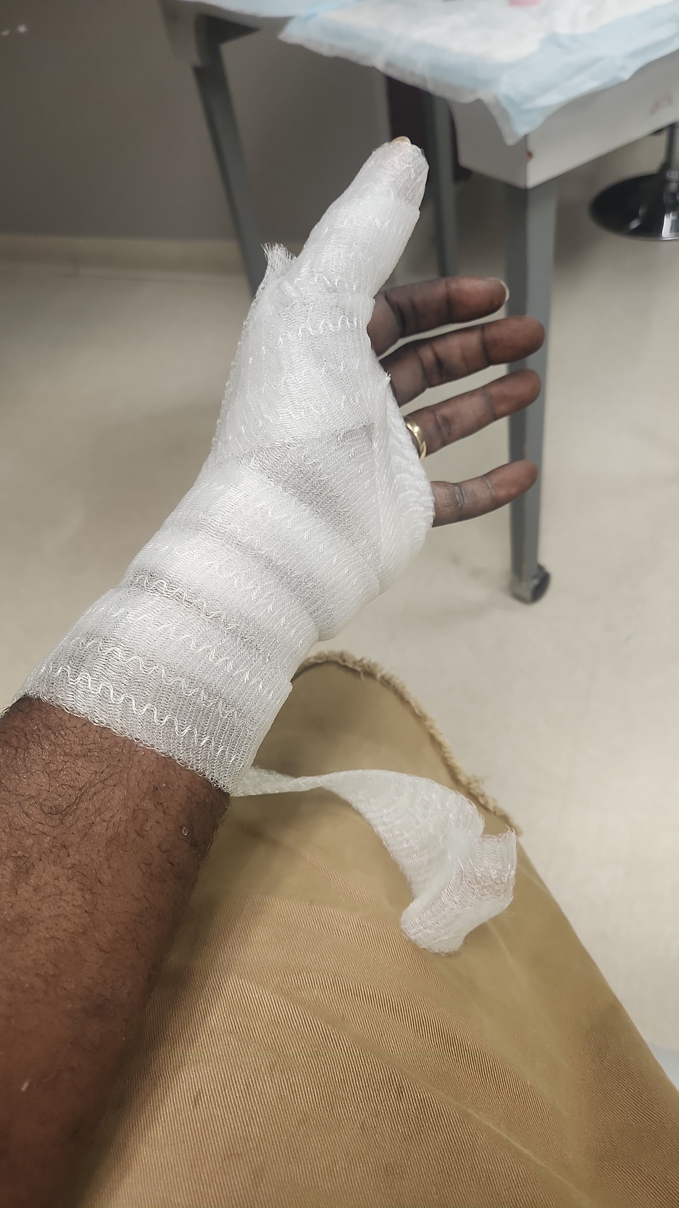 Help Ernecko Heal After Car Accident campaign photo, 5 of 7