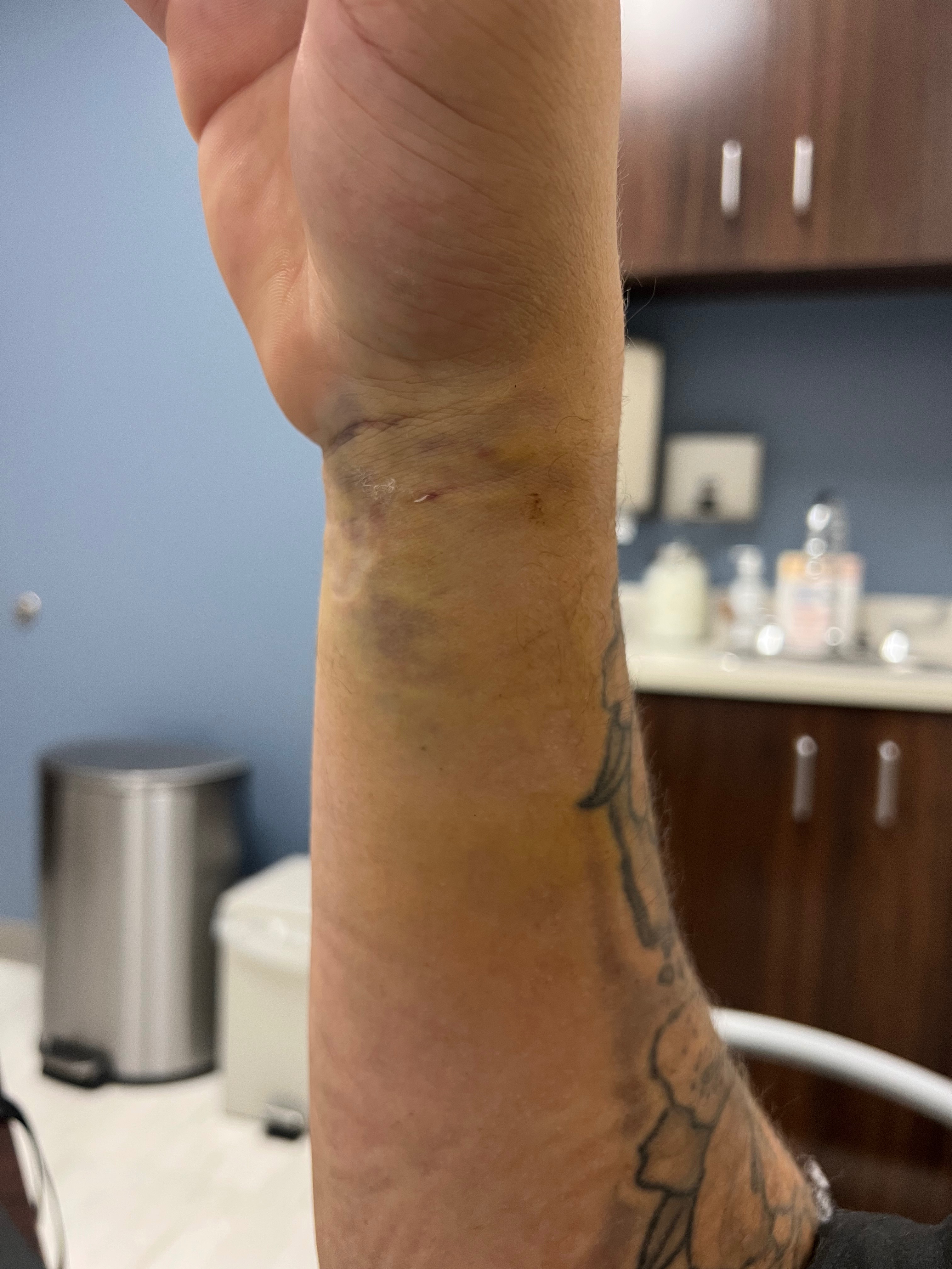 Motorcycle Accident: Husband needs Surgery campaign photo, 2 of 8