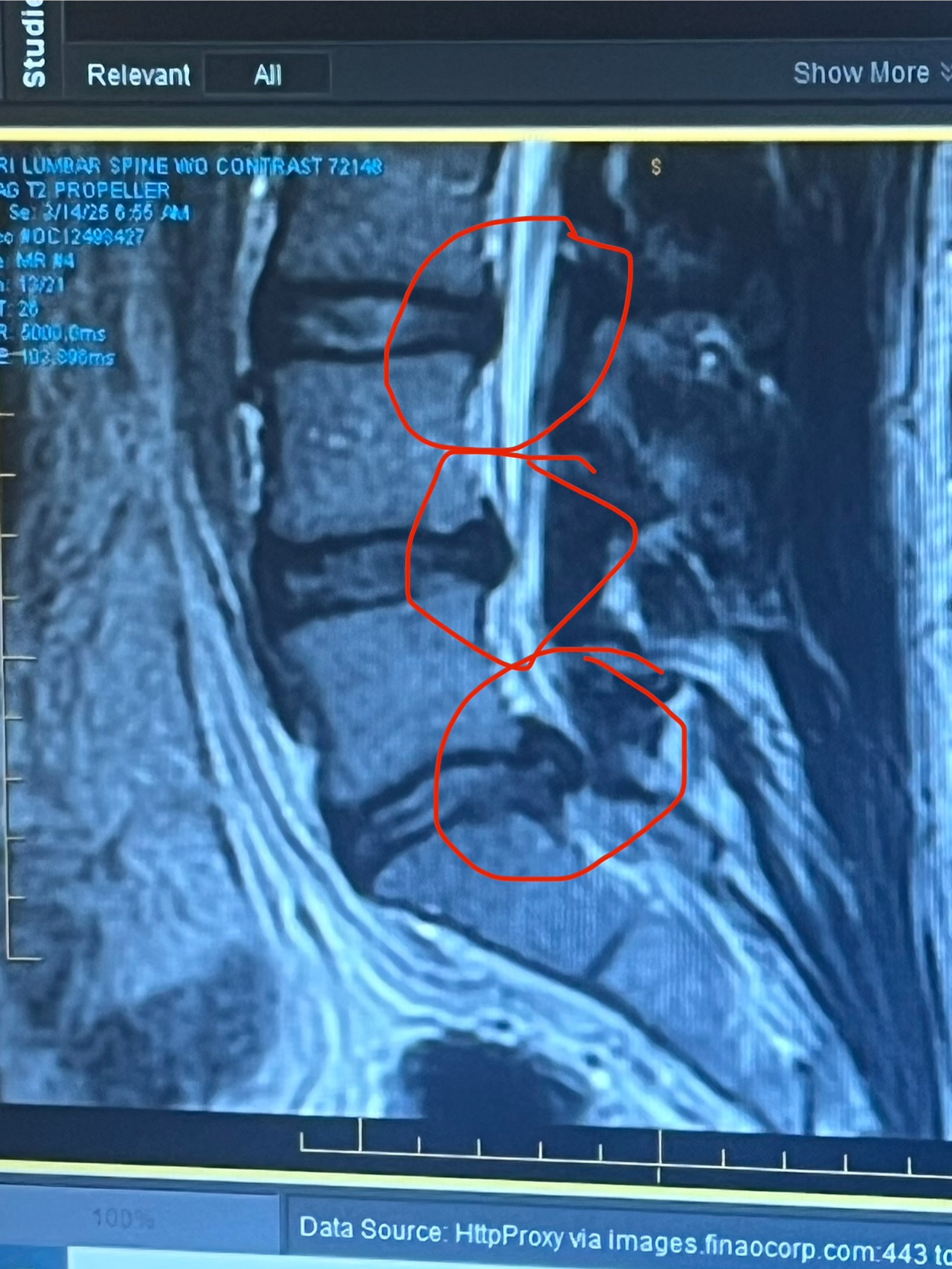 Support Pablo's Surgery for a Pain-Free Future campaign photo, 2 of 4