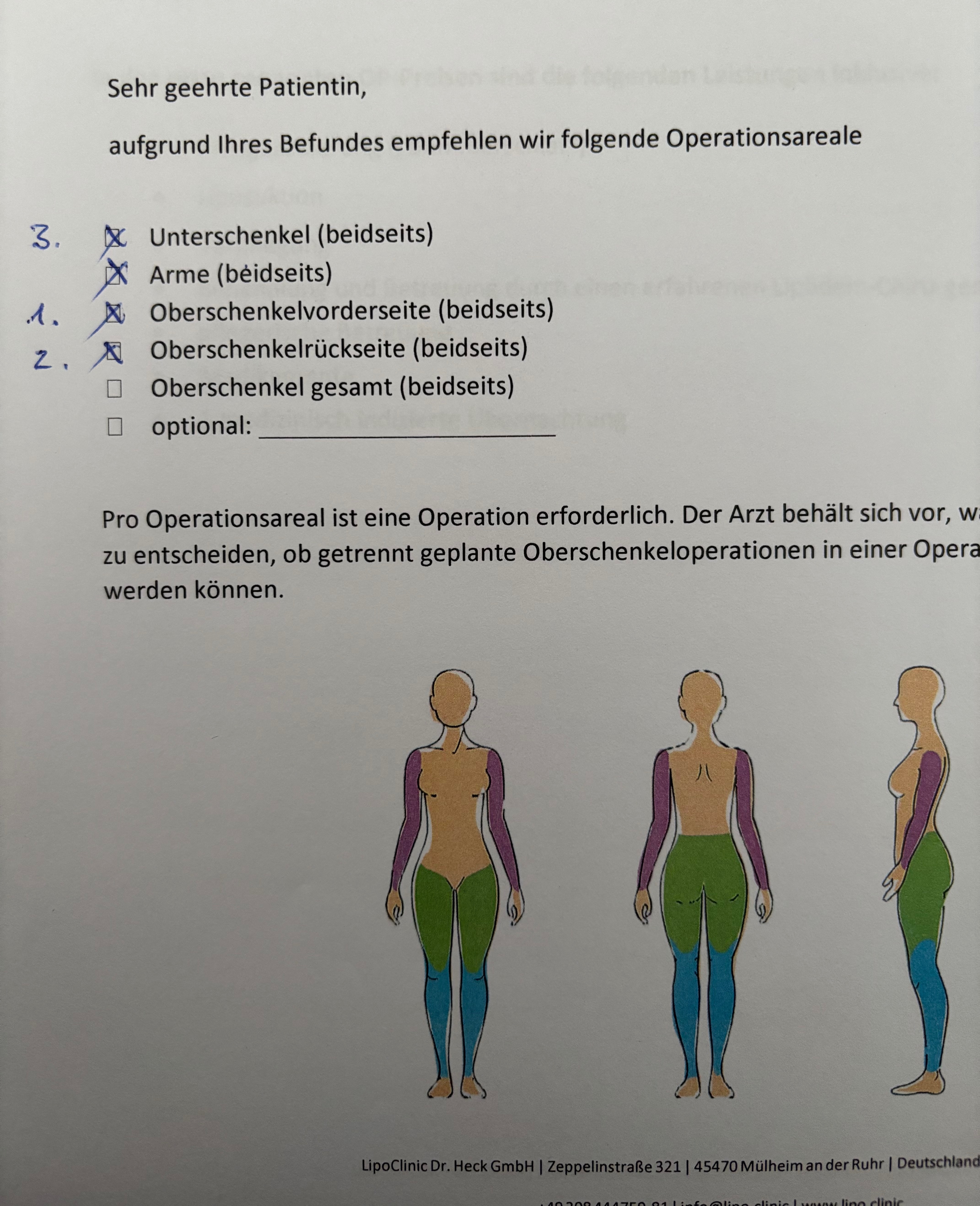 Ich habe Lipödem und bitte um eure Unterstützung für 4 OPs campaign photo, 2 of 6