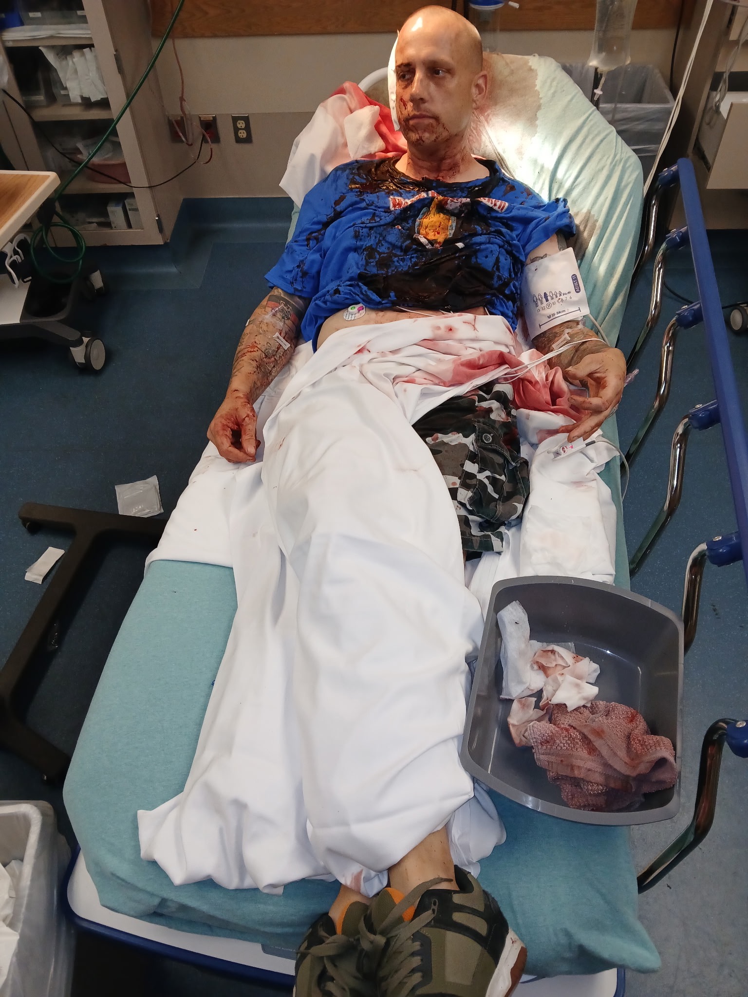 Help Florian Recover from Severe Injury campaign photo, 2 of 7
