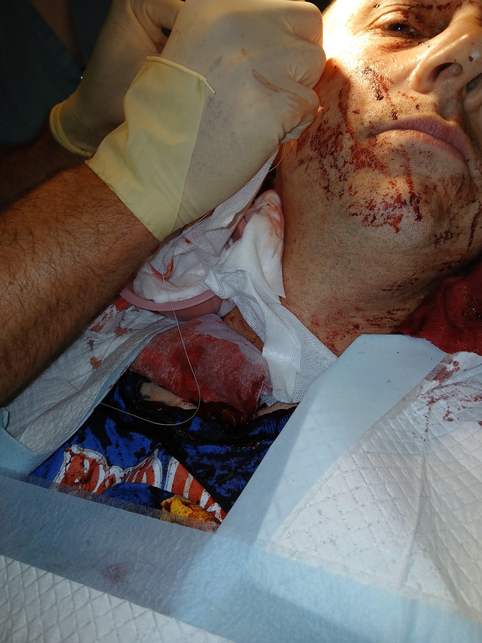 Help Florian Recover from Severe Injury campaign photo, 4 of 7