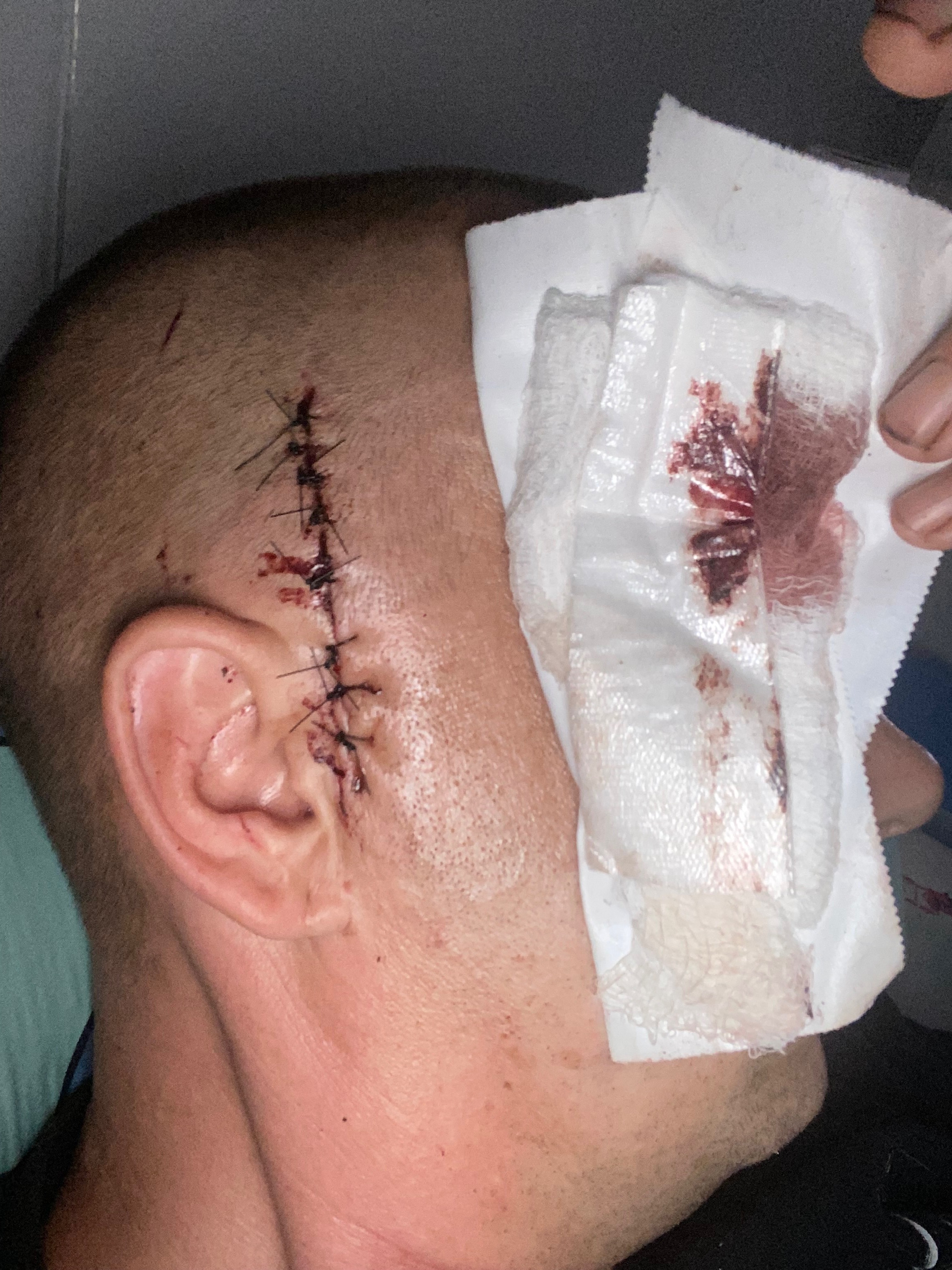 Help Florian Recover from Severe Injury campaign photo, 5 of 7