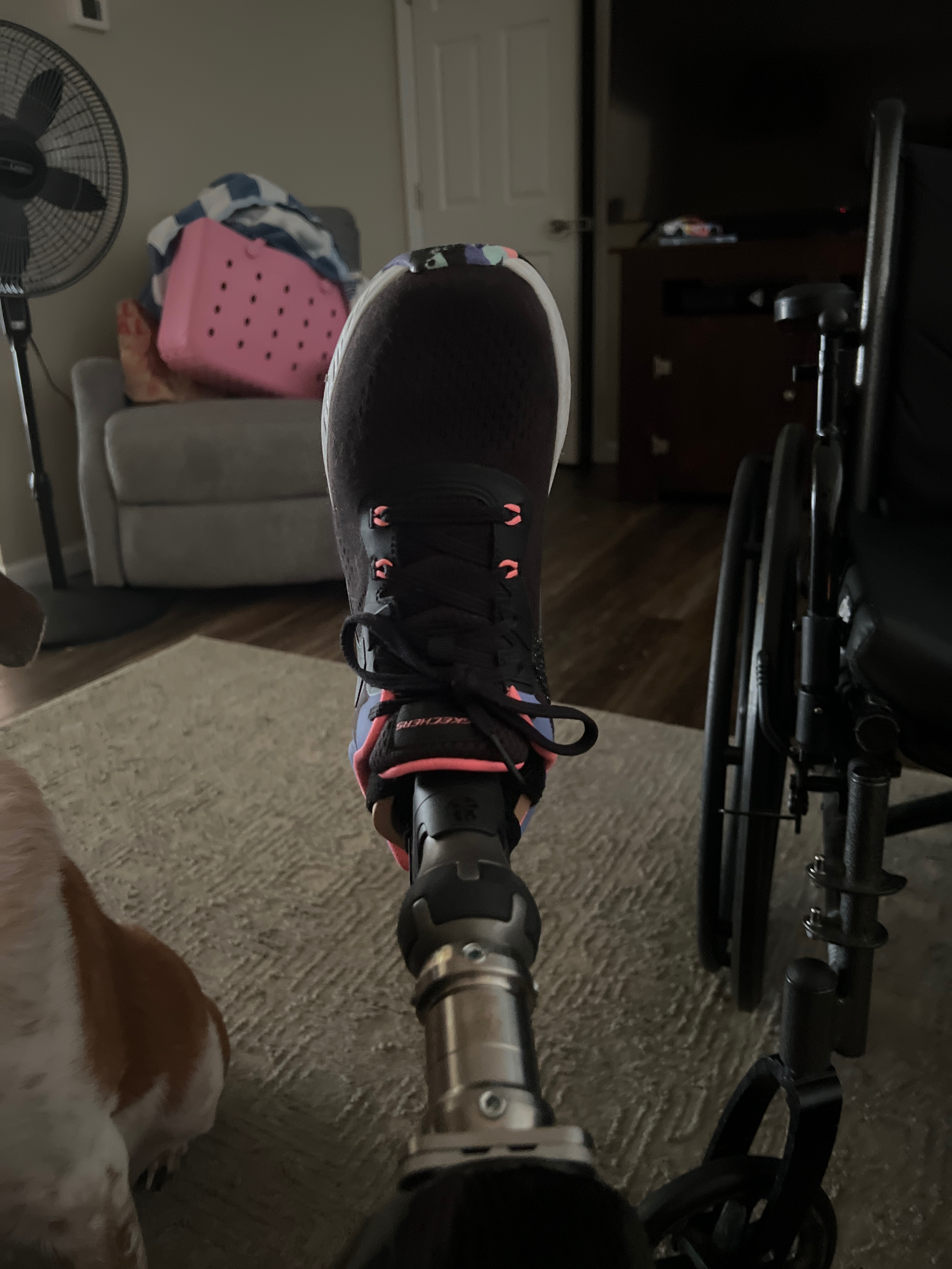 Help Cover the Cost of a Prosthetic Foot campaign photo, 2 of 4