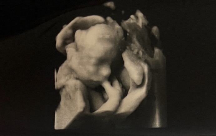Help Carry this Little Family through a High-Risk Pregnancy campaign photo, 7 of 8