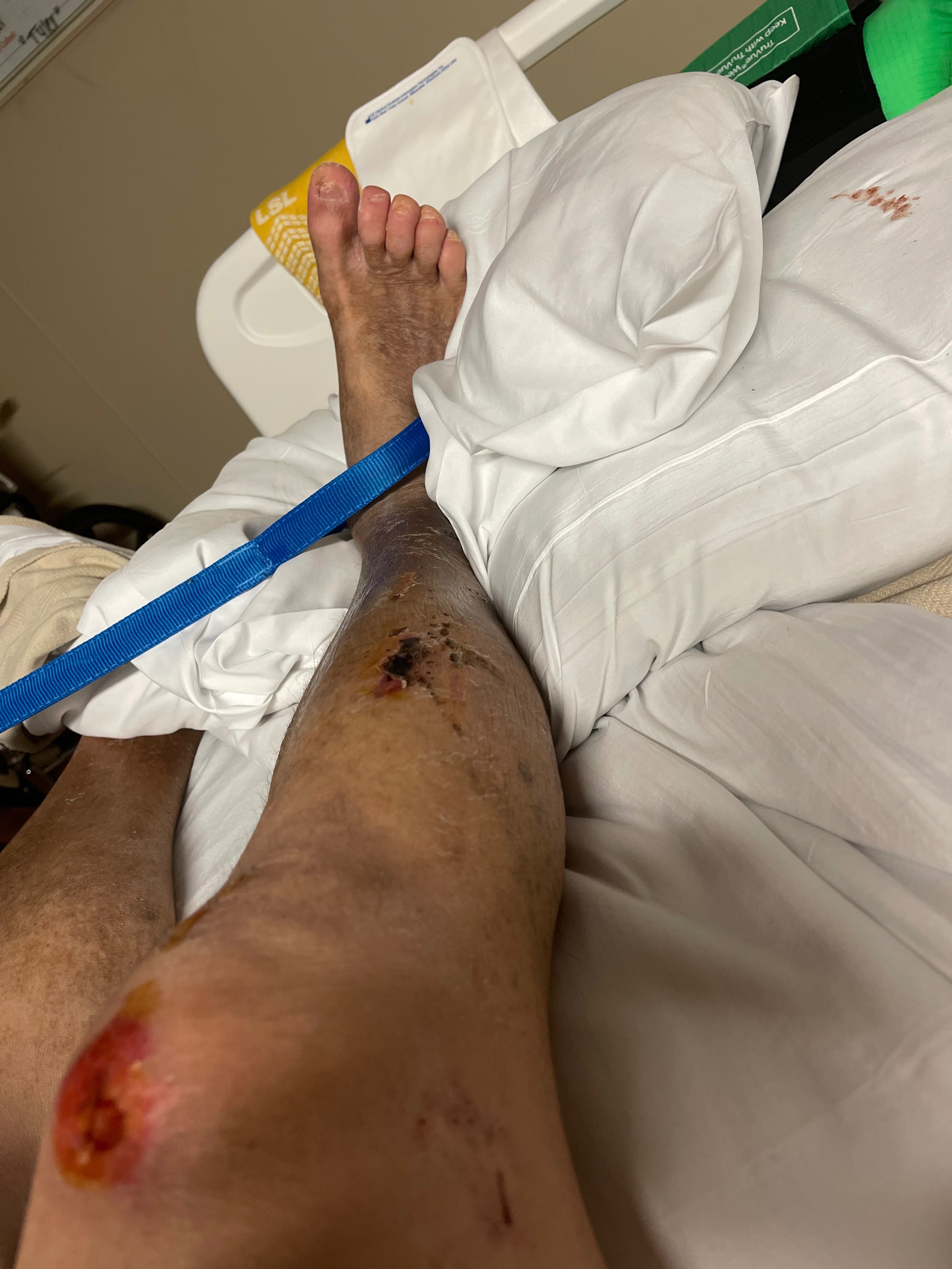 Help Avoid Eviction After Serious Accident campaign photo, 2 of 8