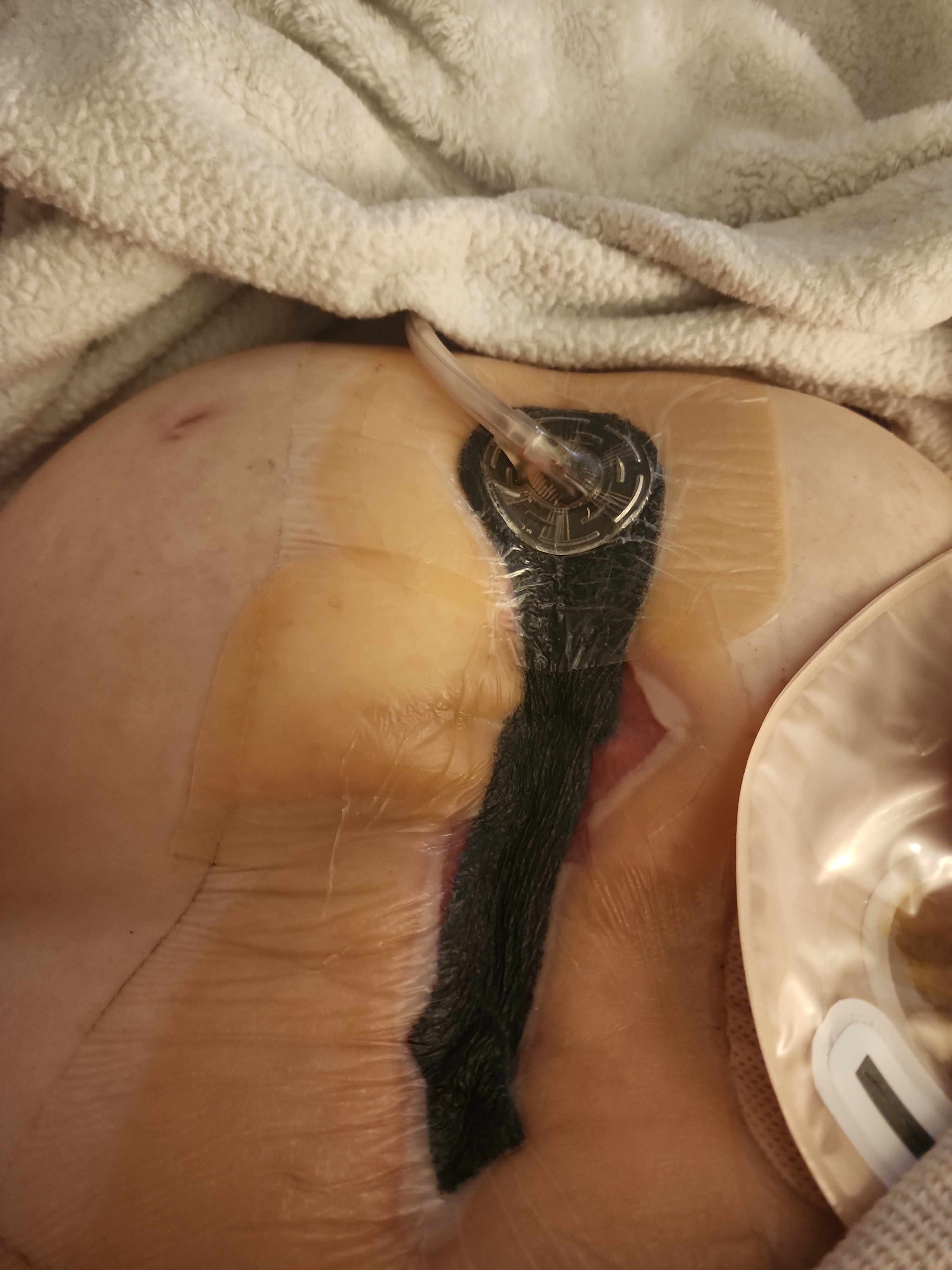 Please Help my family drowning in Medical Debt. campaign photo, 5 of 8