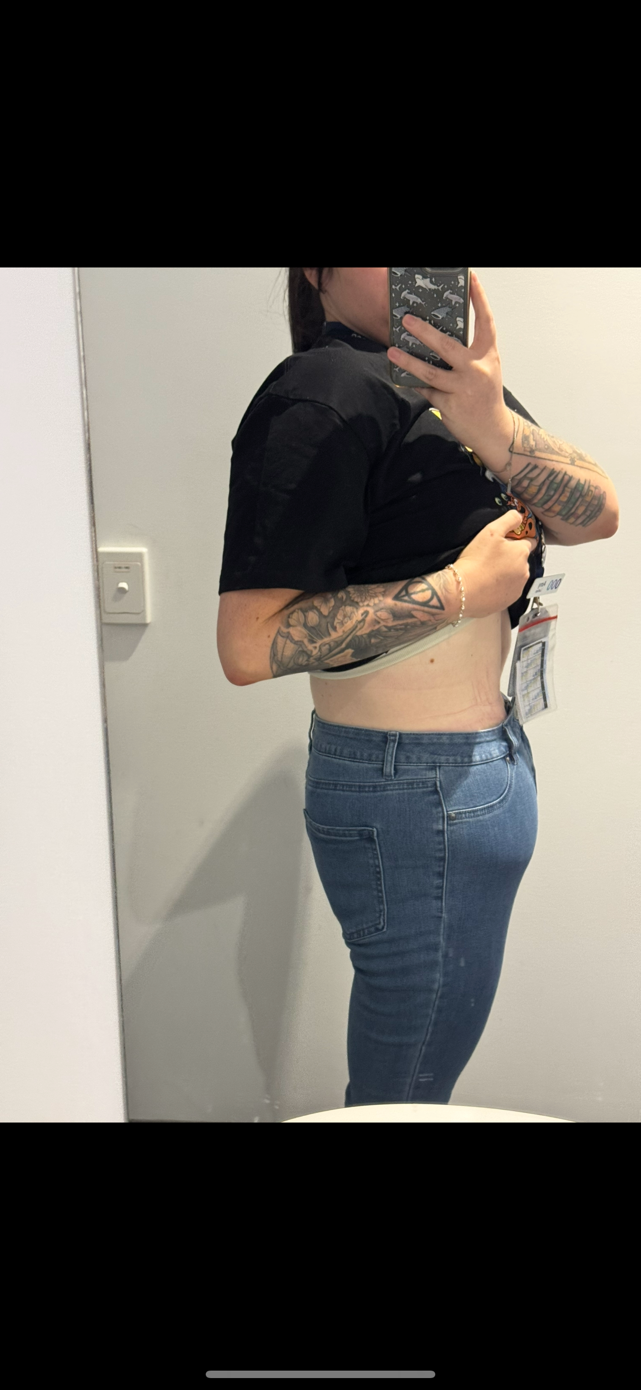 Help me remove my skin post weight loss! campaign photo, 5 of 8