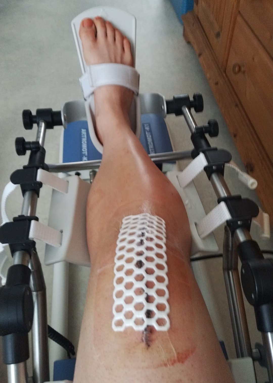 Hilfe für dringende Behandlung nach Knie-OP campaign photo, 7 of 8