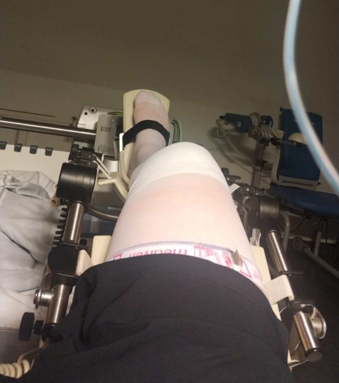 Hilfe für dringende Behandlung nach Knie-OP campaign photo, 2 of 8