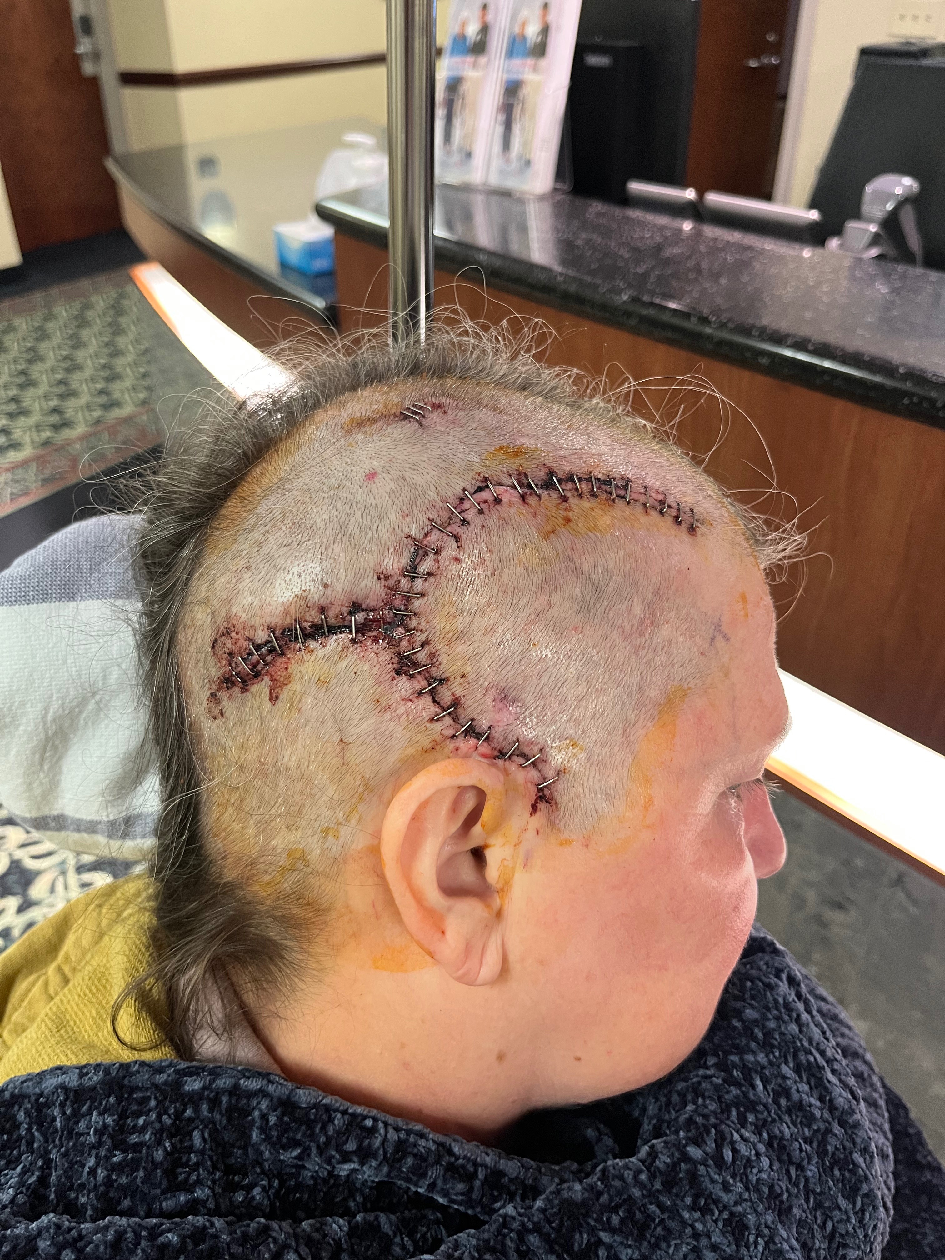 Stand with Bev: Veteran Facing Glioblastoma campaign photo, 2 of 8