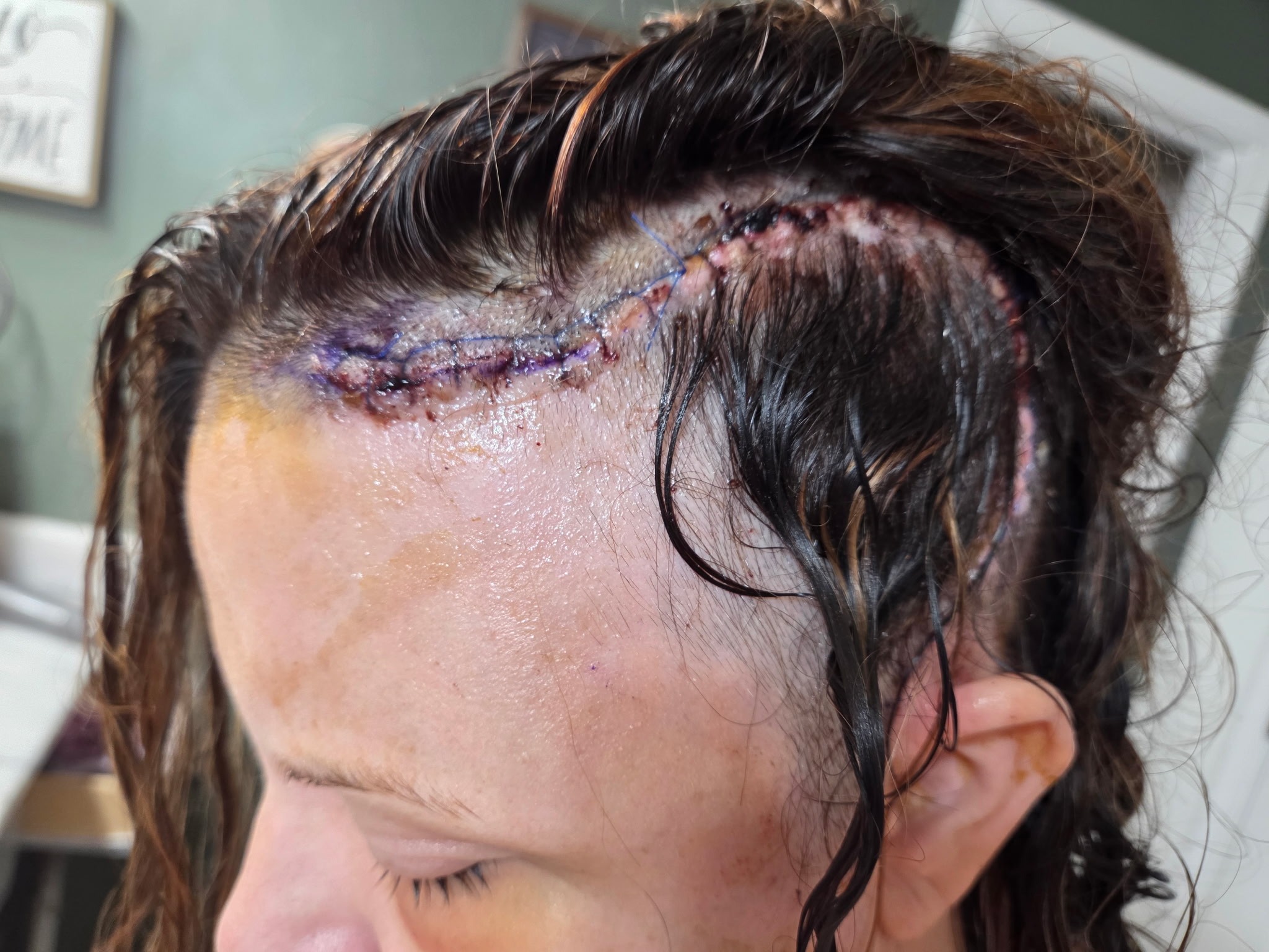 Beth's Continued Tumor Fight: Family Needs Your Help campaign photo, 4 of 6