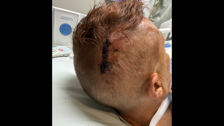 Help David to Heal from Multiple Gunshots campaign photo, 2 of 4