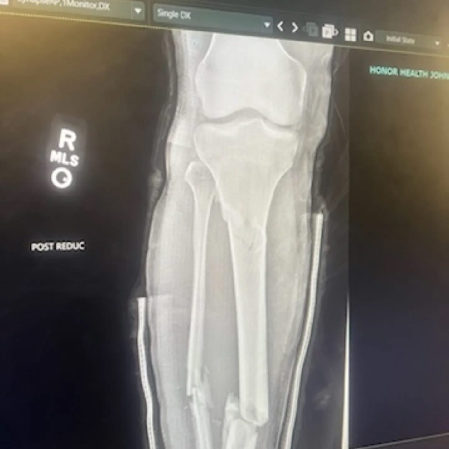 Help Support Dane's Road to Recovery campaign photo, 4 of 8