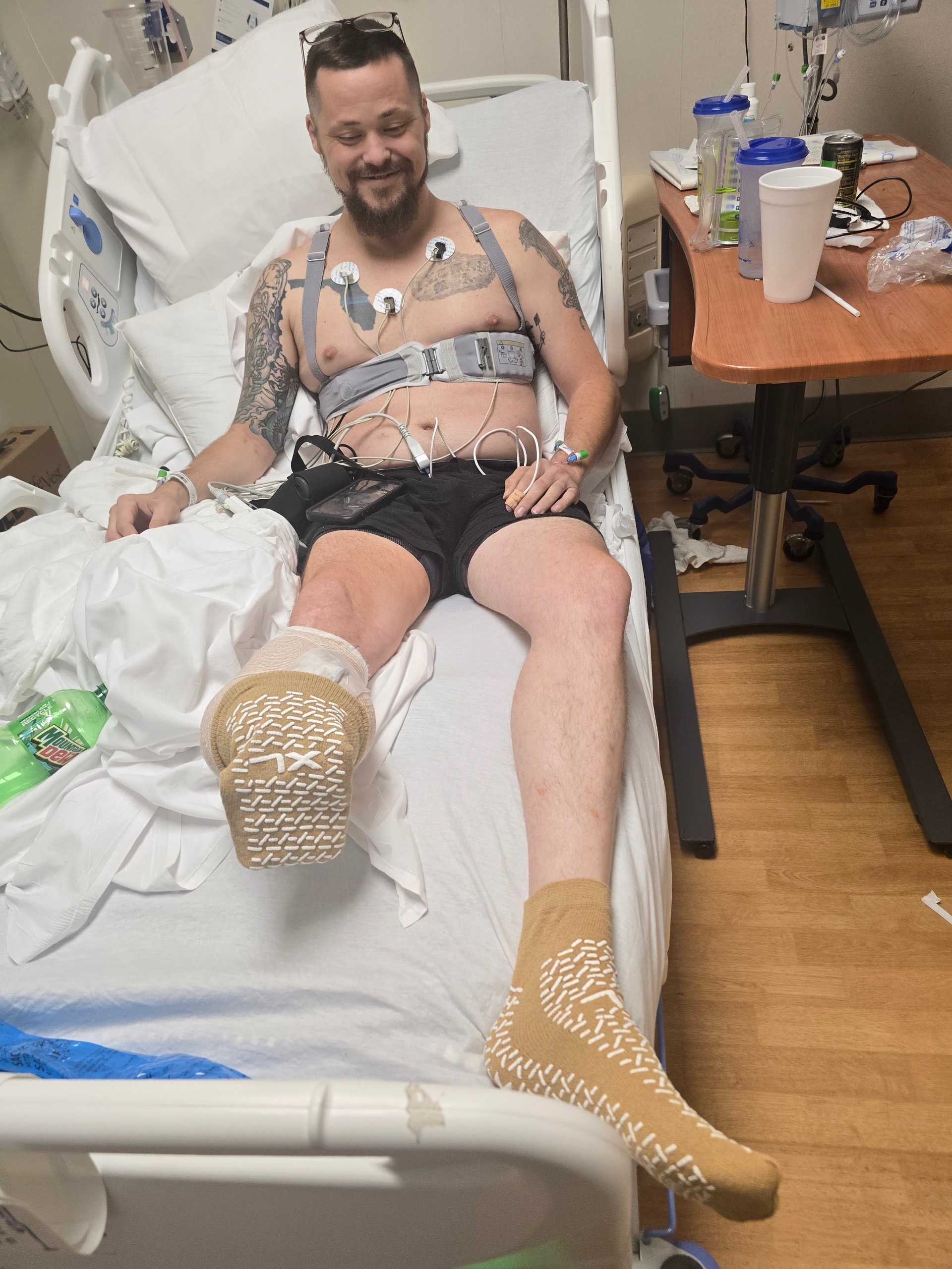 Donate to Michael Altman's Prosthetic Leg Fund campaign photo, 2 of 5