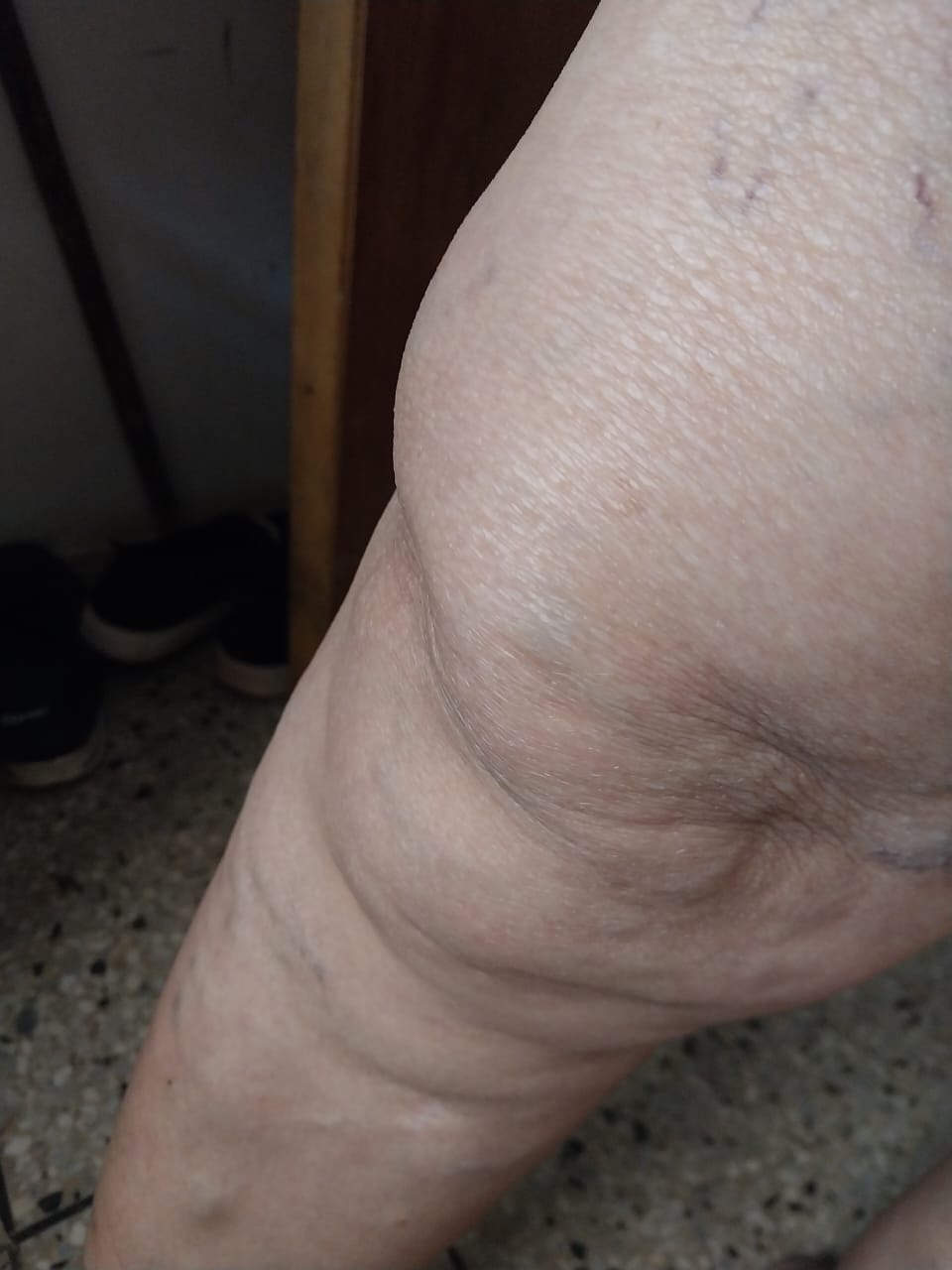 Give Cristina a Better Life: Surgery Fundraiser campaign photo, 4 of 8