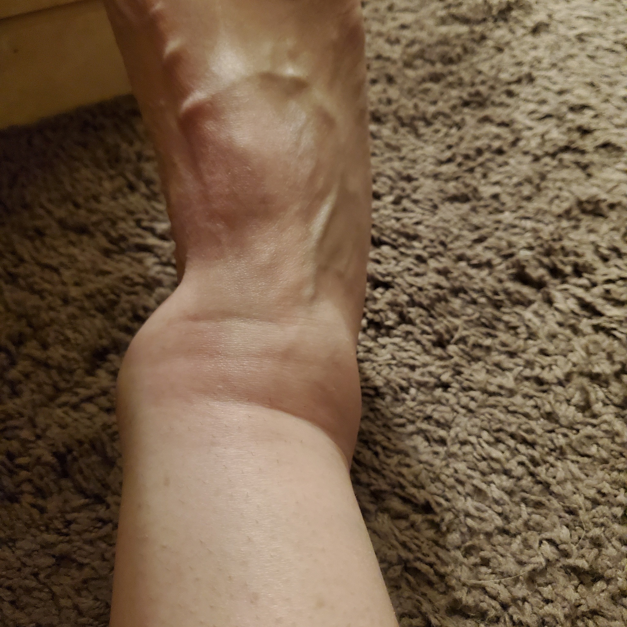 Support Jen: Get Her Back on Her Feet After Ankle Injury campaign photo, 2 of 6