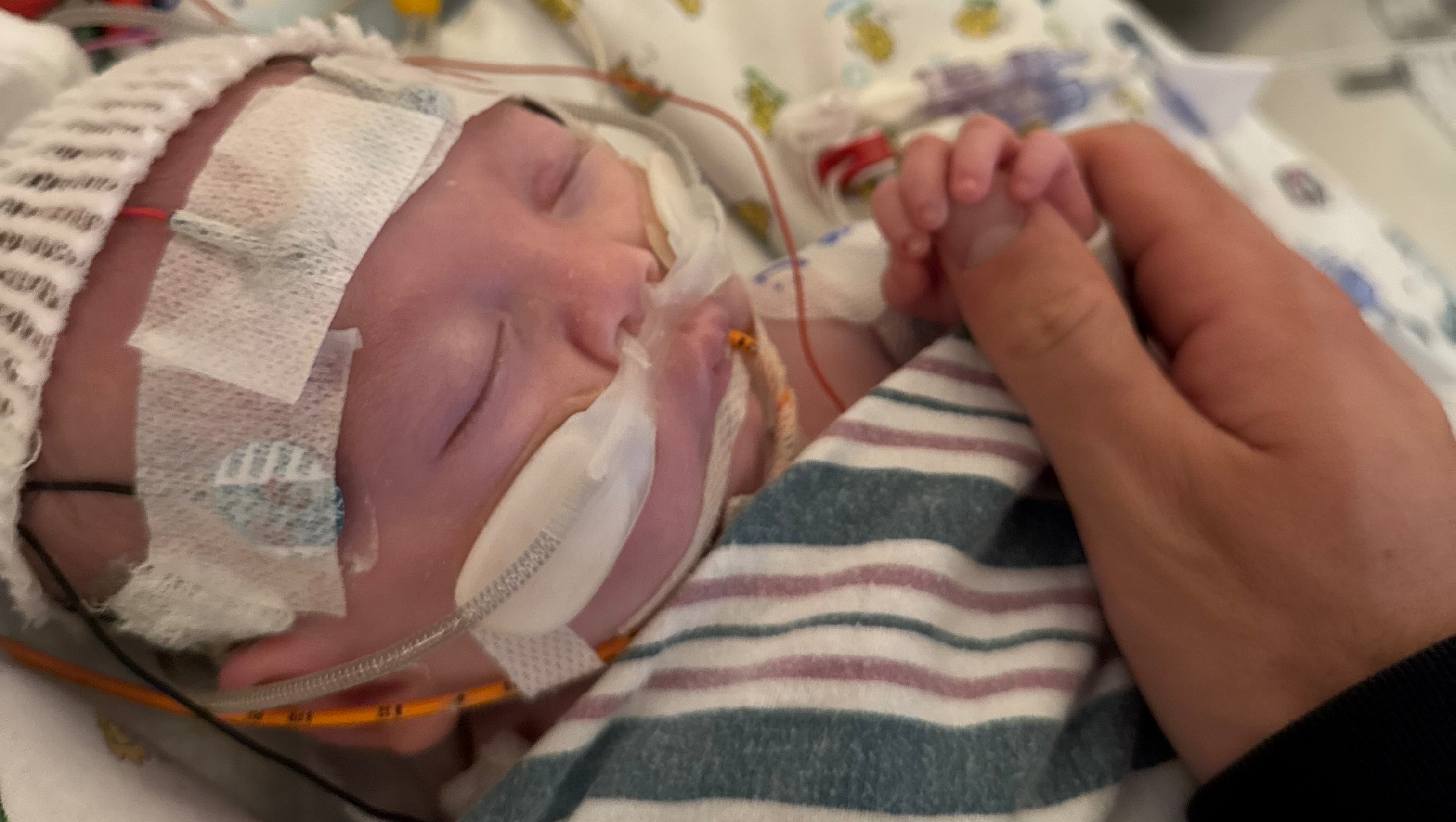Elijah’s Medical Journey – Help His Parents Stay by His Side