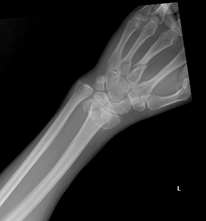 Arturo's Journey to Recovery and Healing campaign photo, 7 of 8