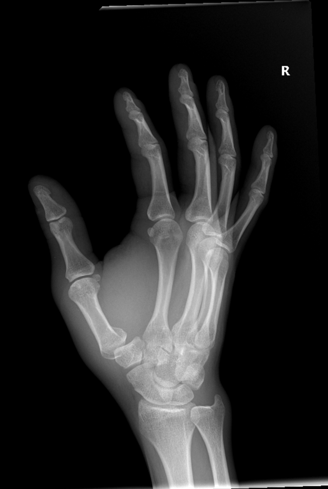 Arturo's Journey to Recovery and Healing campaign photo, 2 of 8
